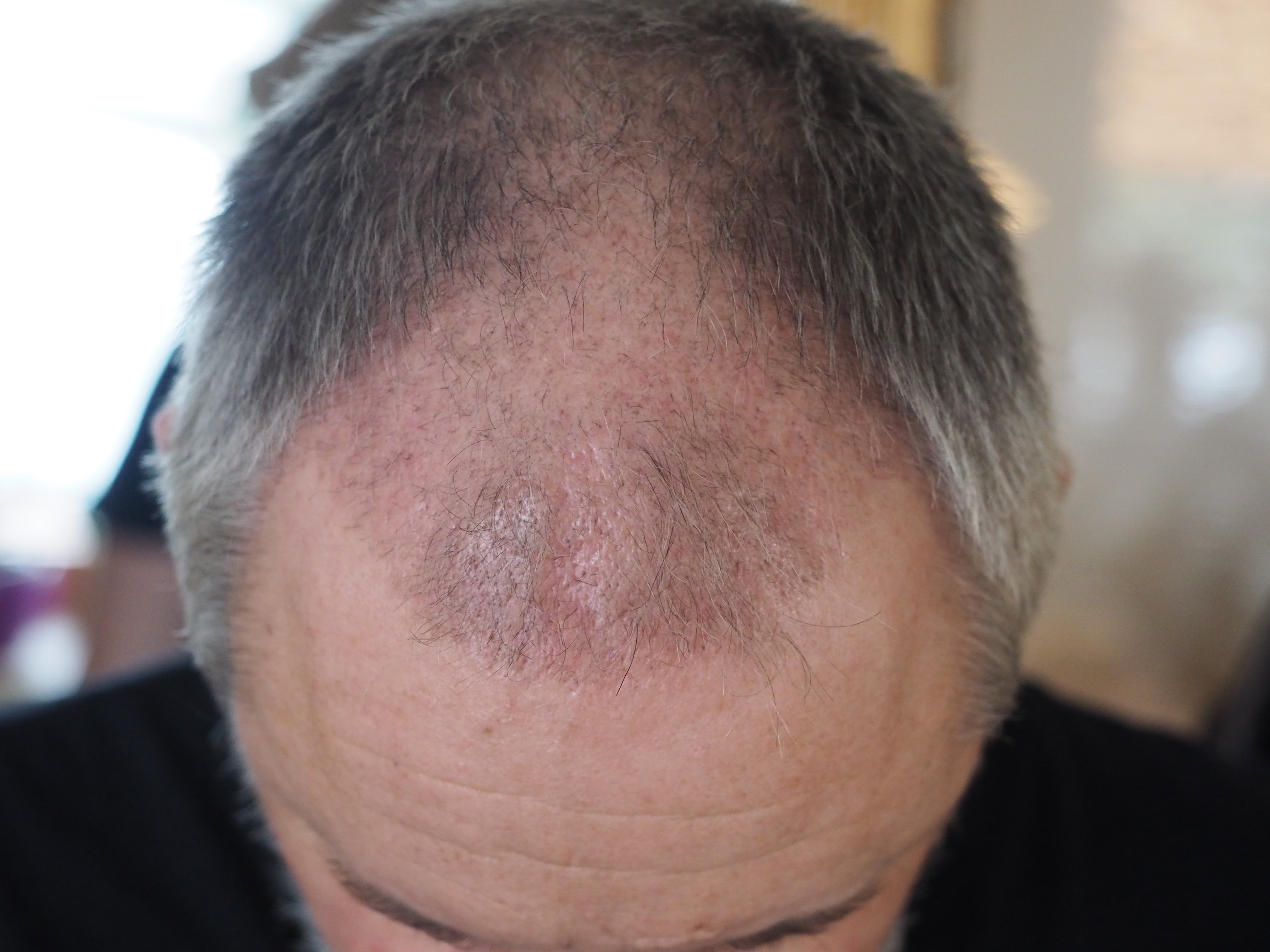 /foren/transplant/index.php/fa/50451/0/