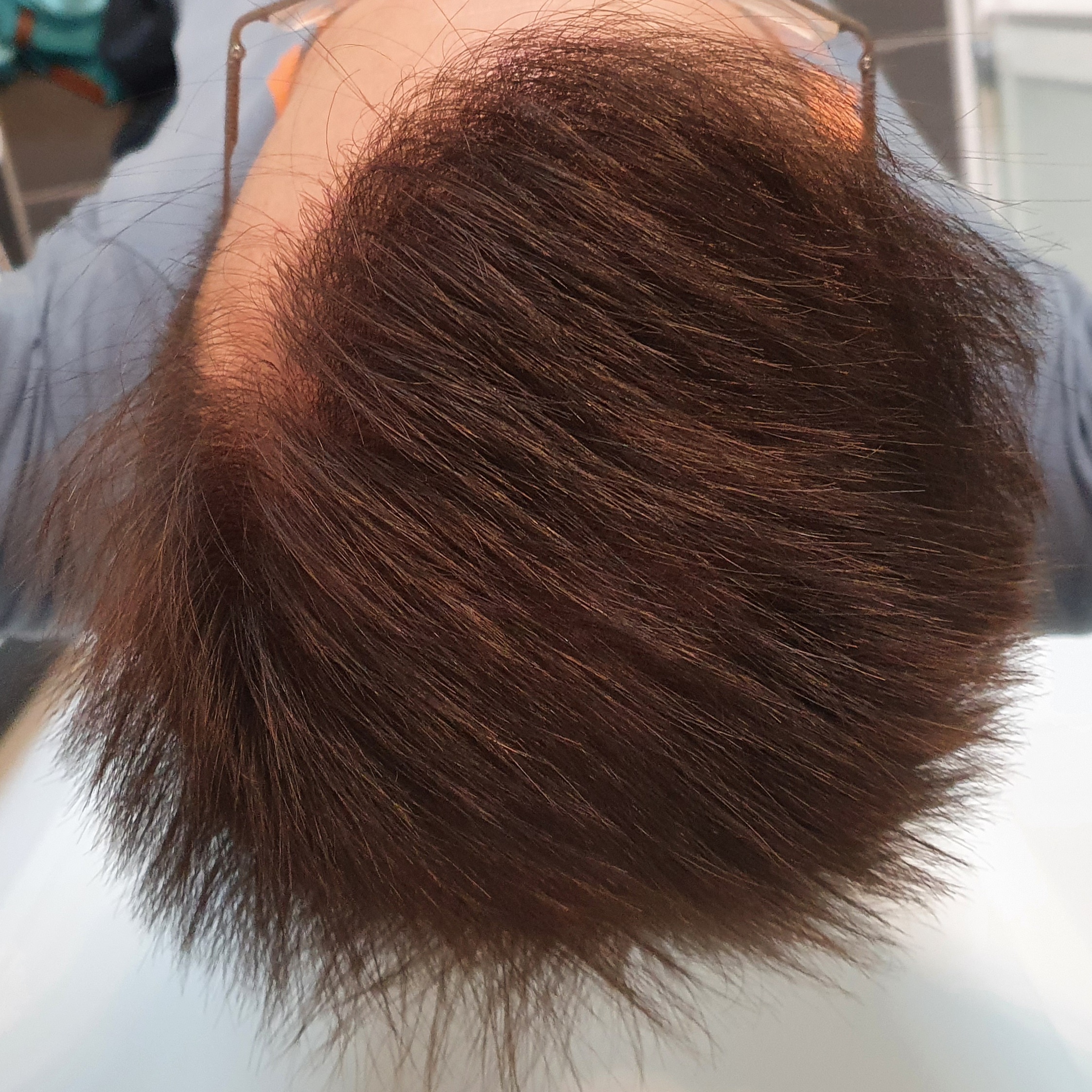 /foren/transplant/index.php/fa/50556/0/