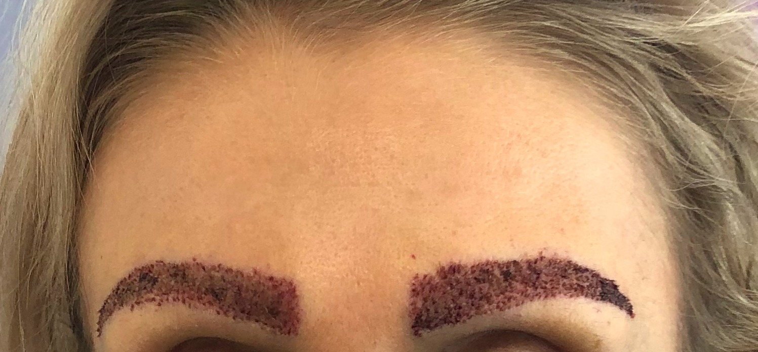 /foren/transplant/index.php/fa/50586/0/