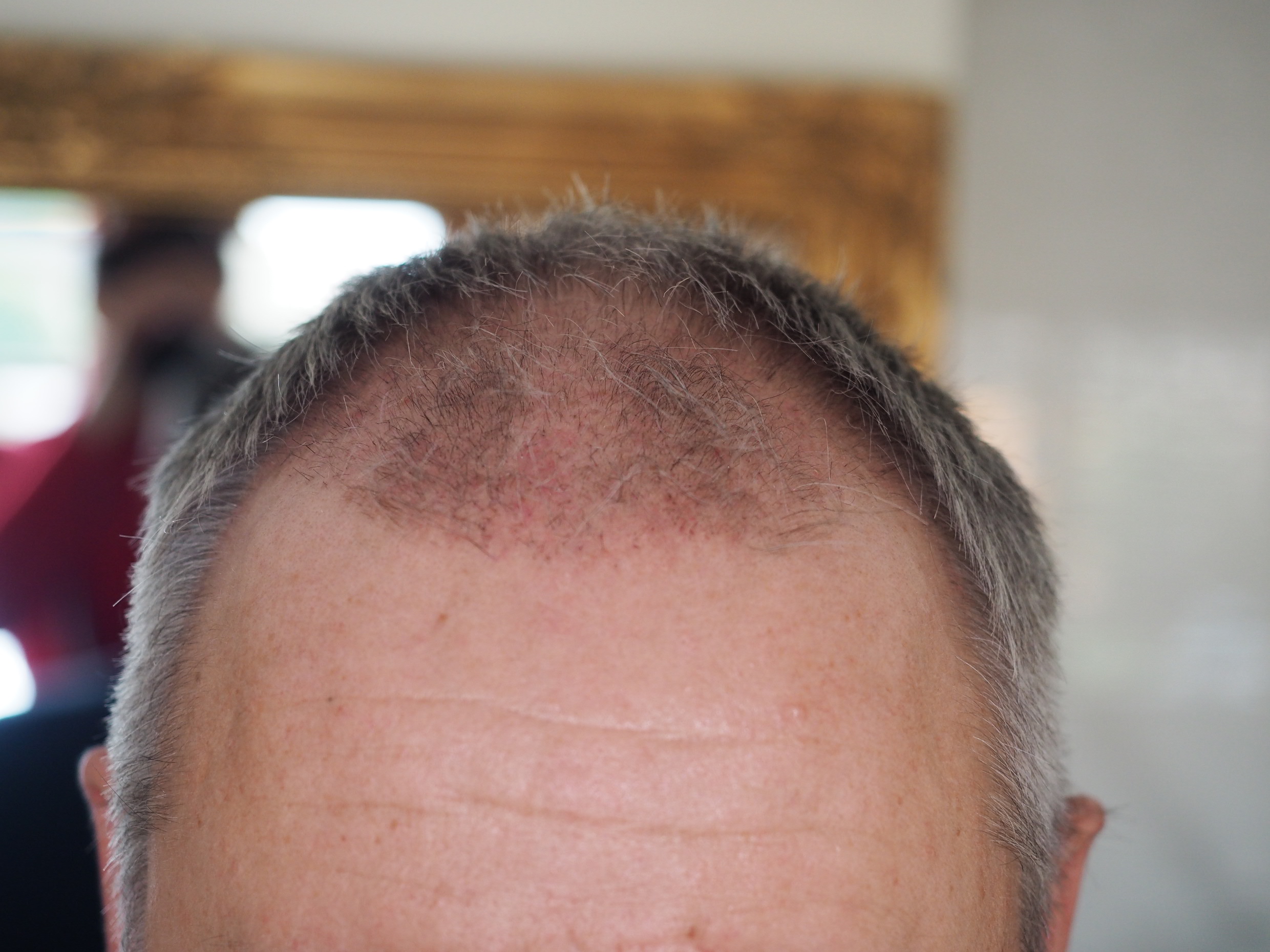 /foren/transplant/index.php/fa/50624/0/