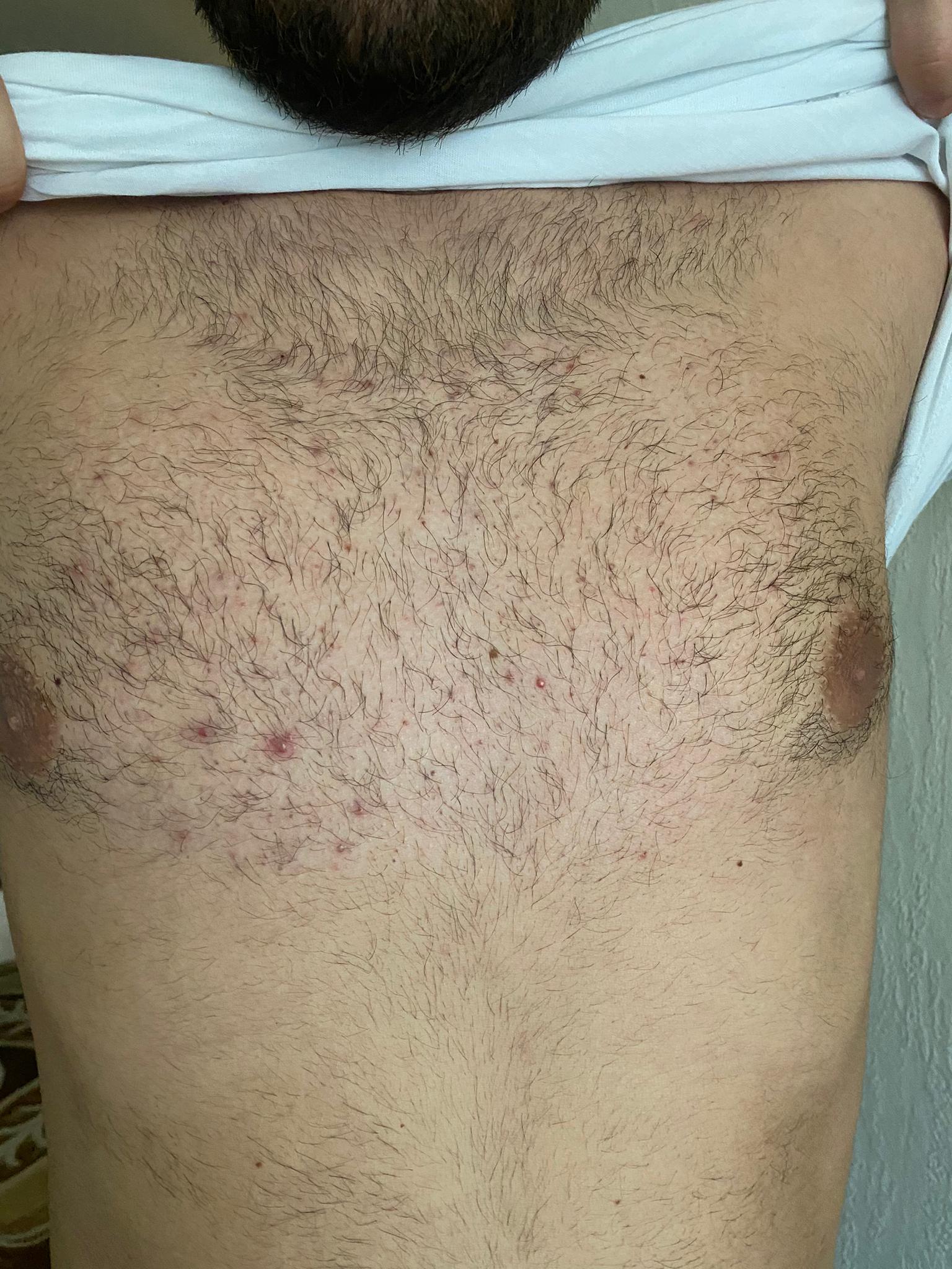 /foren/transplant/index.php/fa/50674/0/