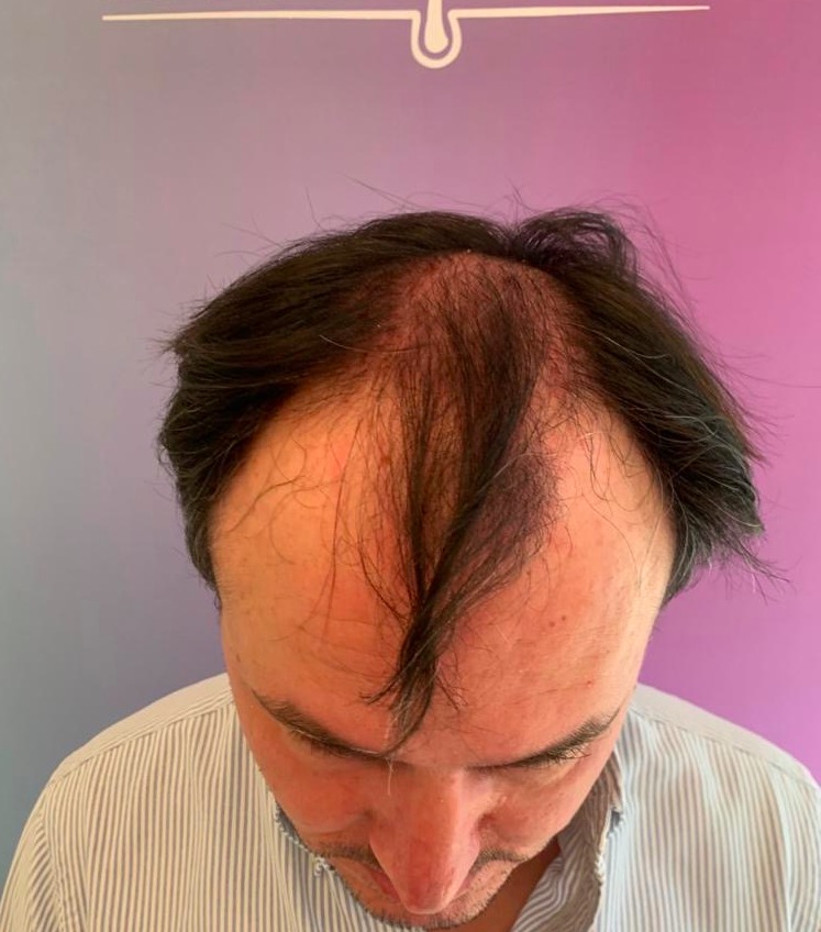 /foren/transplant/index.php/fa/50711/0/