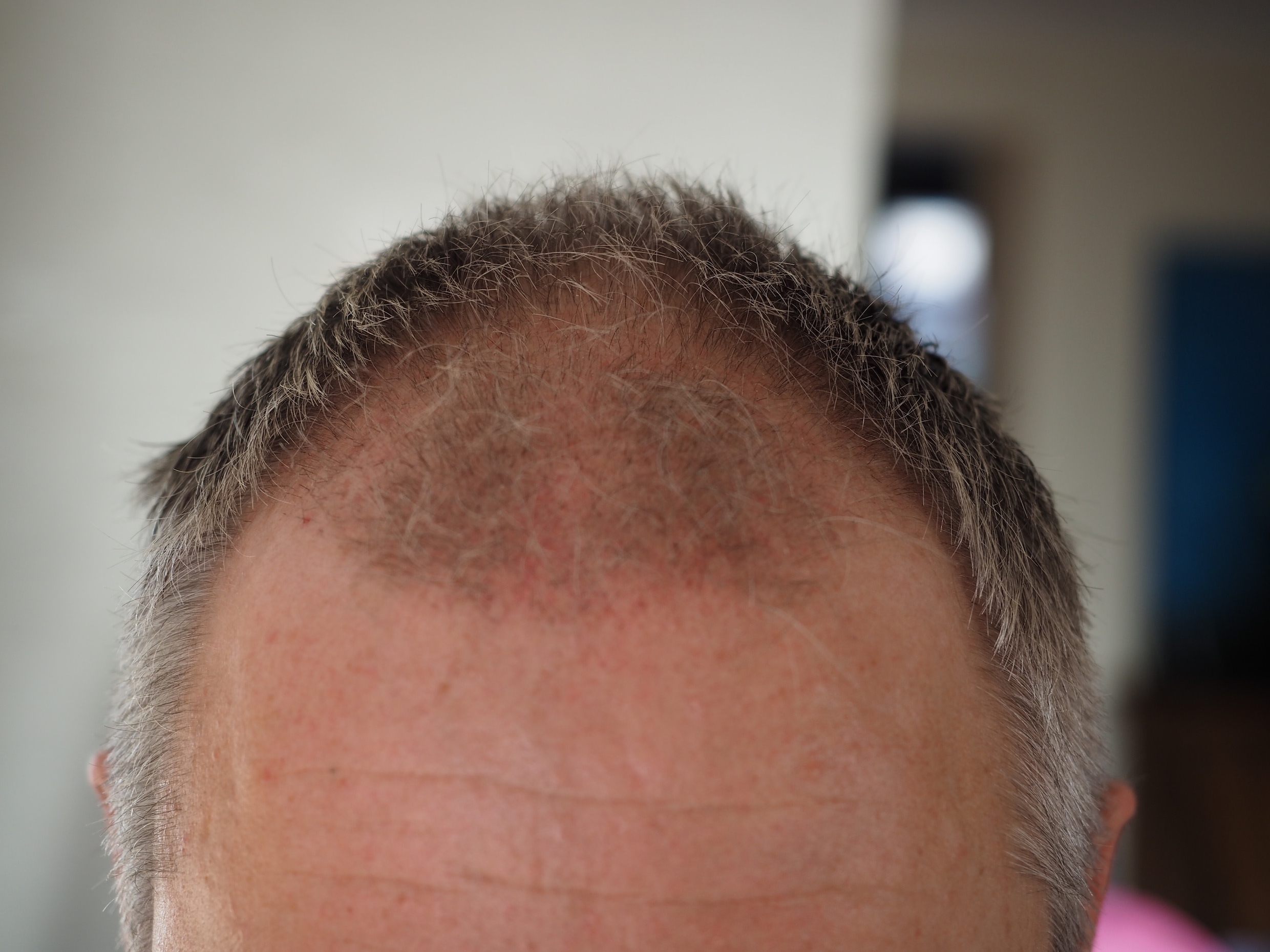 /foren/transplant/index.php/fa/50720/0/