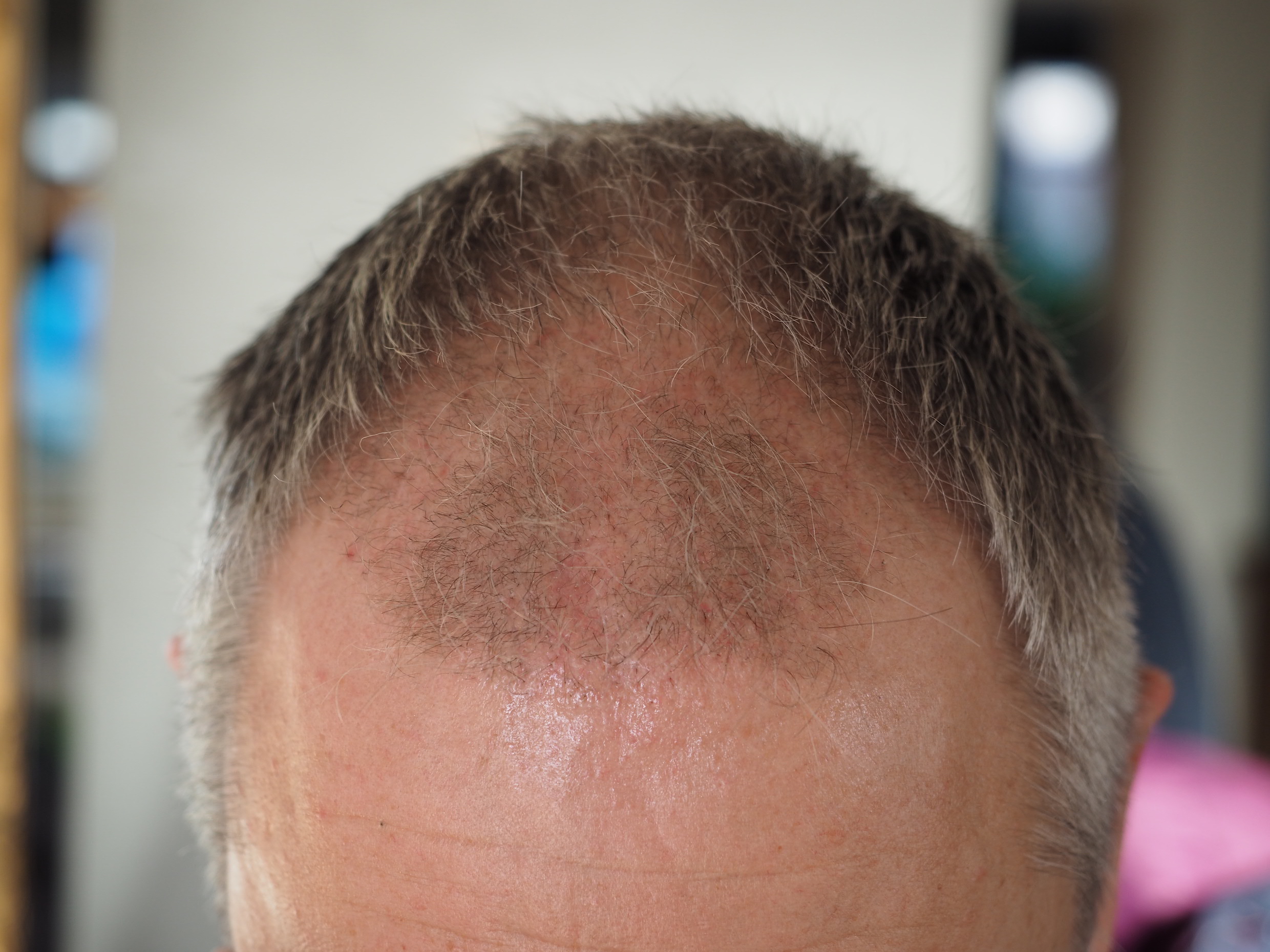 /foren/transplant/index.php/fa/50721/0/