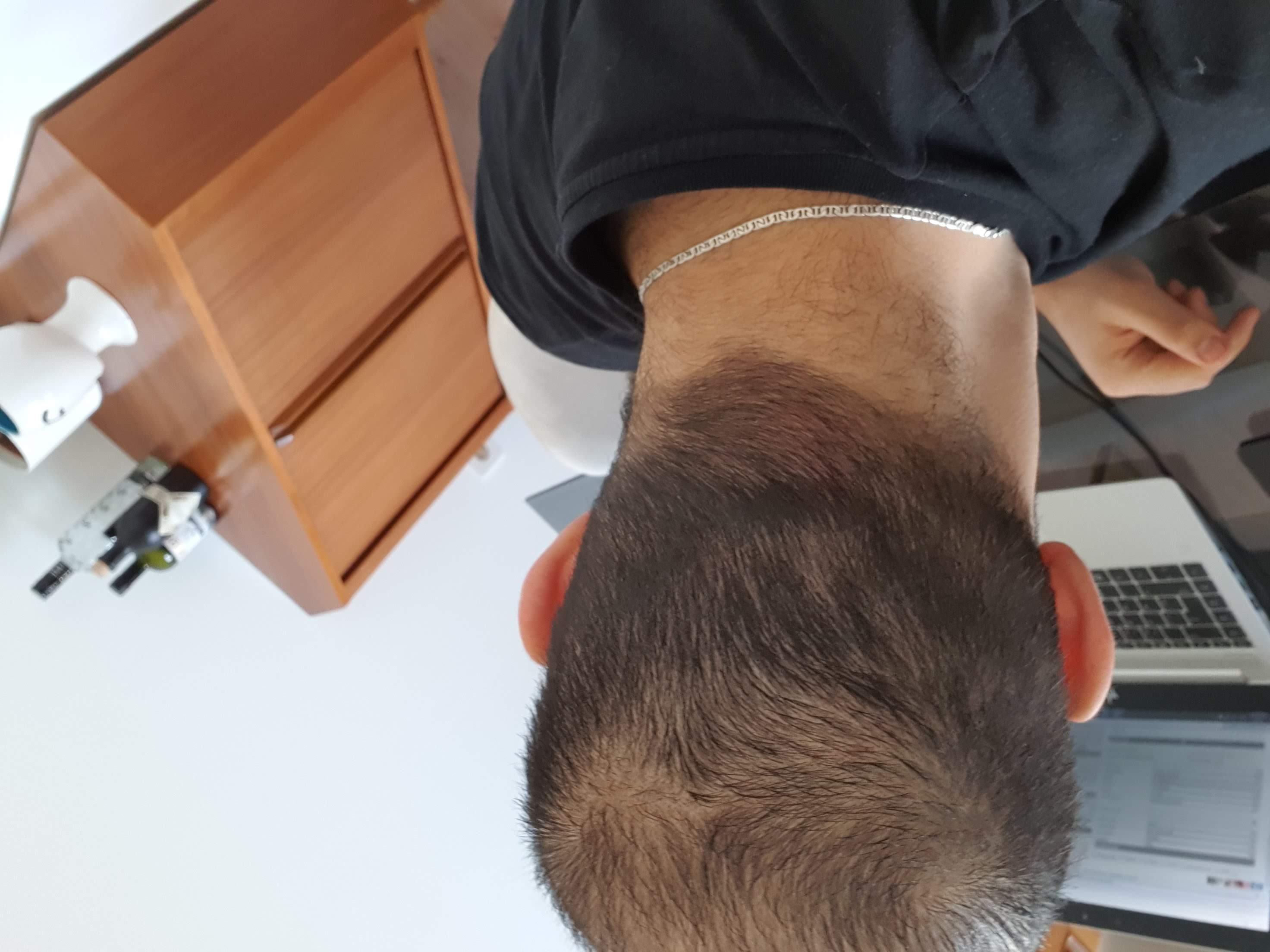 /foren/transplant/index.php/fa/50746/0/