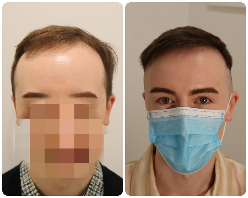 /foren/transplant/index.php/fa/50802/0/