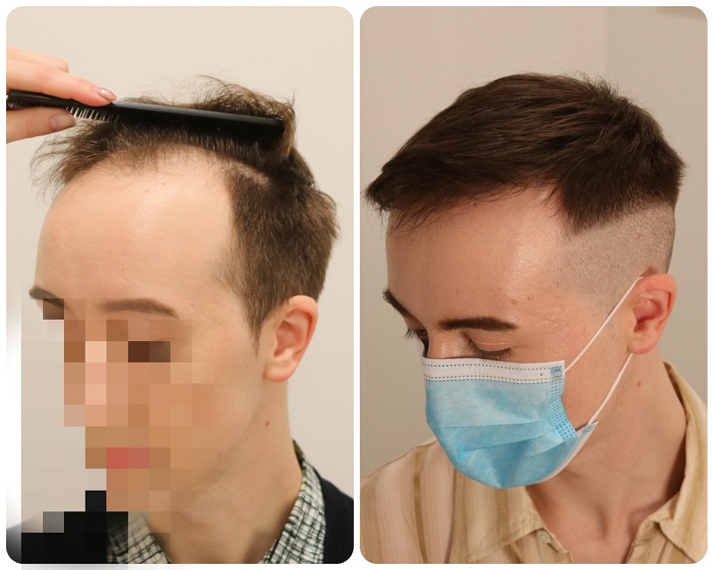 /foren/transplant/index.php/fa/50803/0/