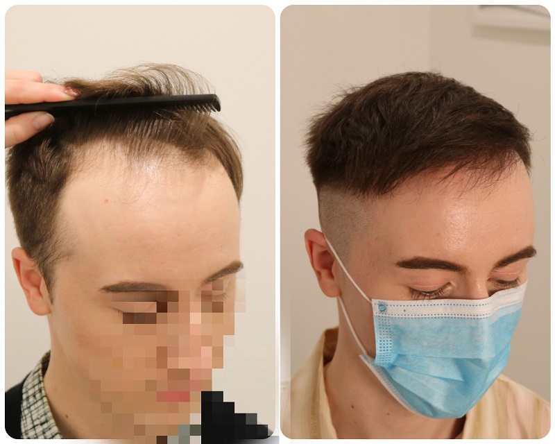 /foren/transplant/index.php/fa/50804/0/