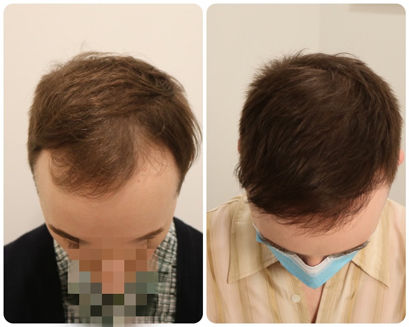 /foren/transplant/index.php/fa/50805/0/