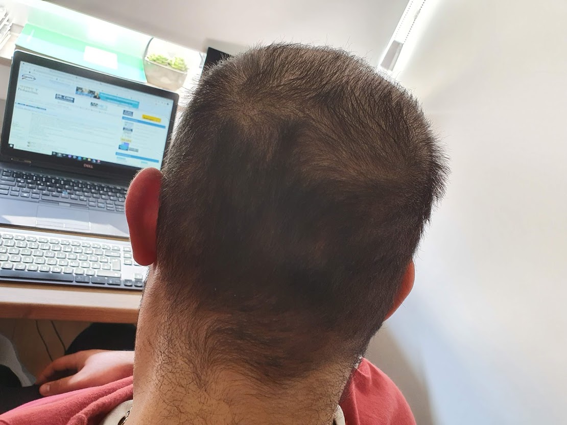 /foren/transplant/index.php/fa/50909/0/