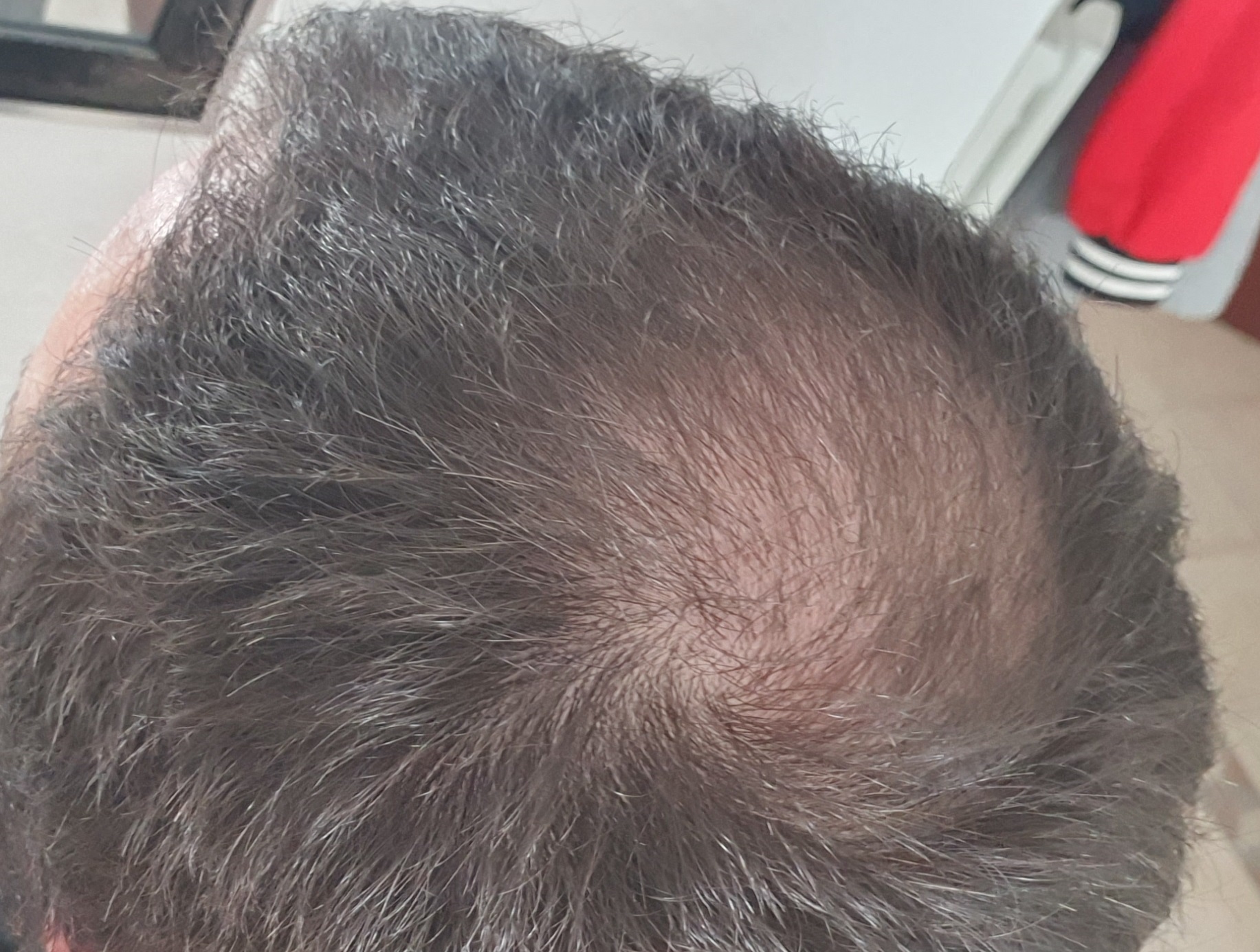 /foren/transplant/index.php/fa/50939/0/