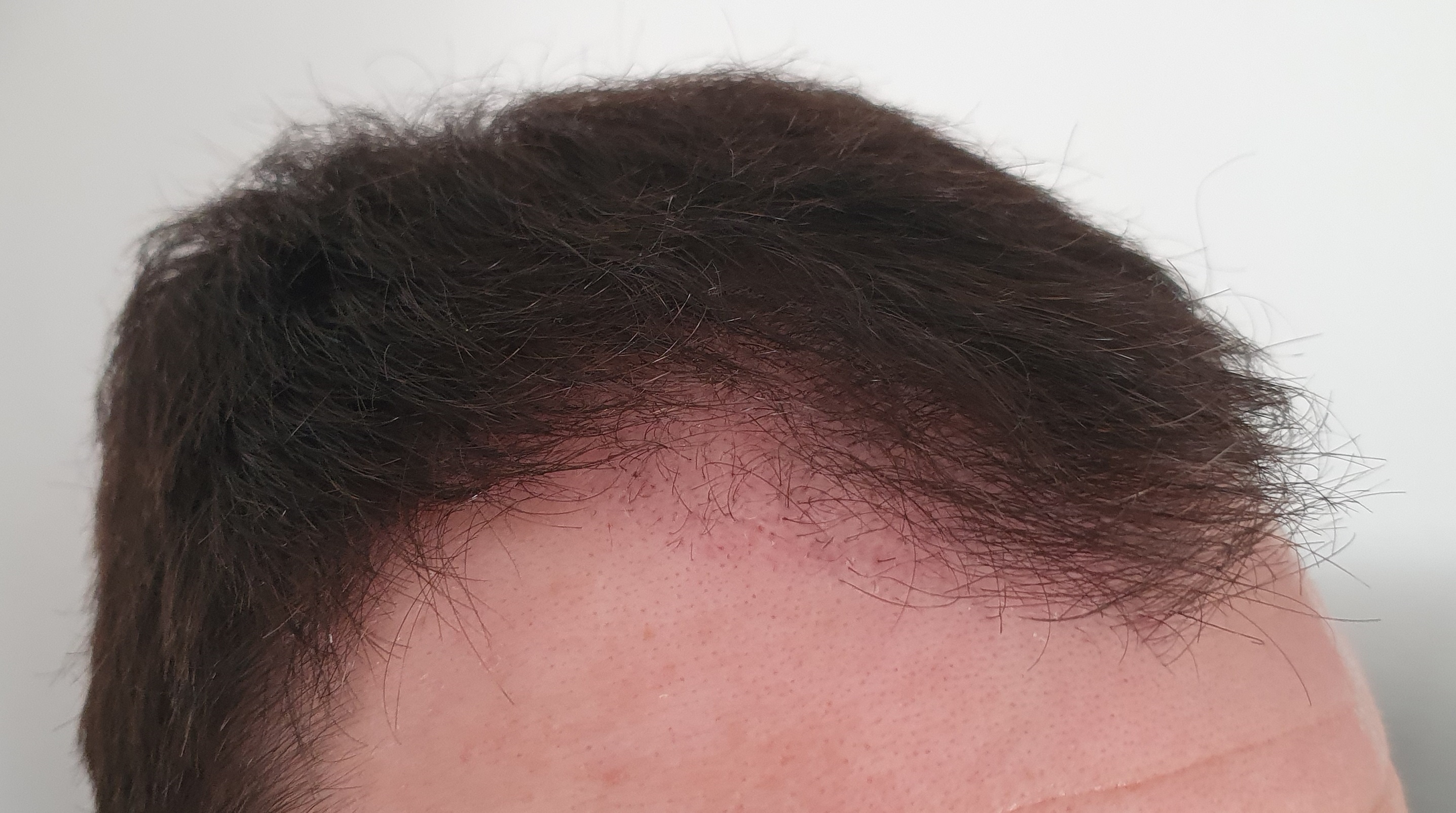 /foren/transplant/index.php/fa/50940/0/