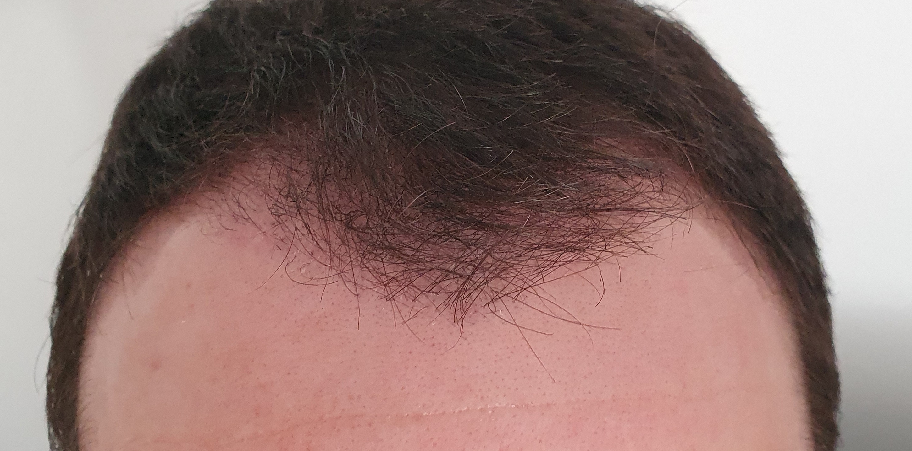 /foren/transplant/index.php/fa/50941/0/