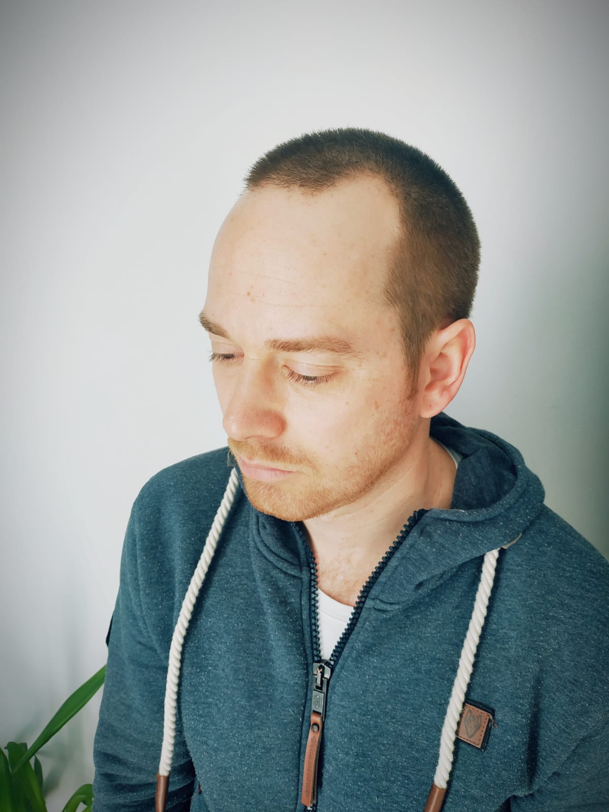 /foren/transplant/index.php/fa/50949/0/