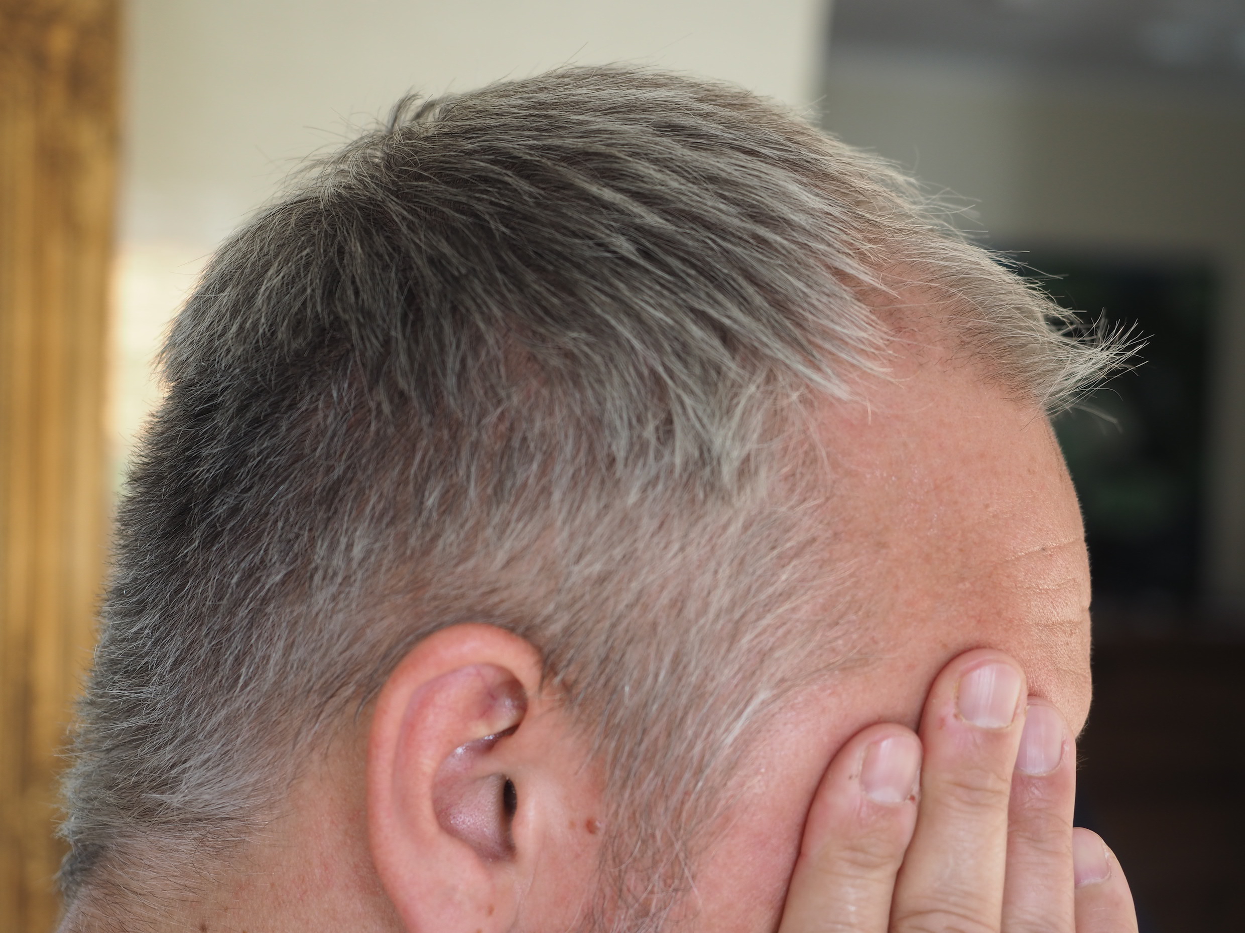 /foren/transplant/index.php/fa/50969/0/