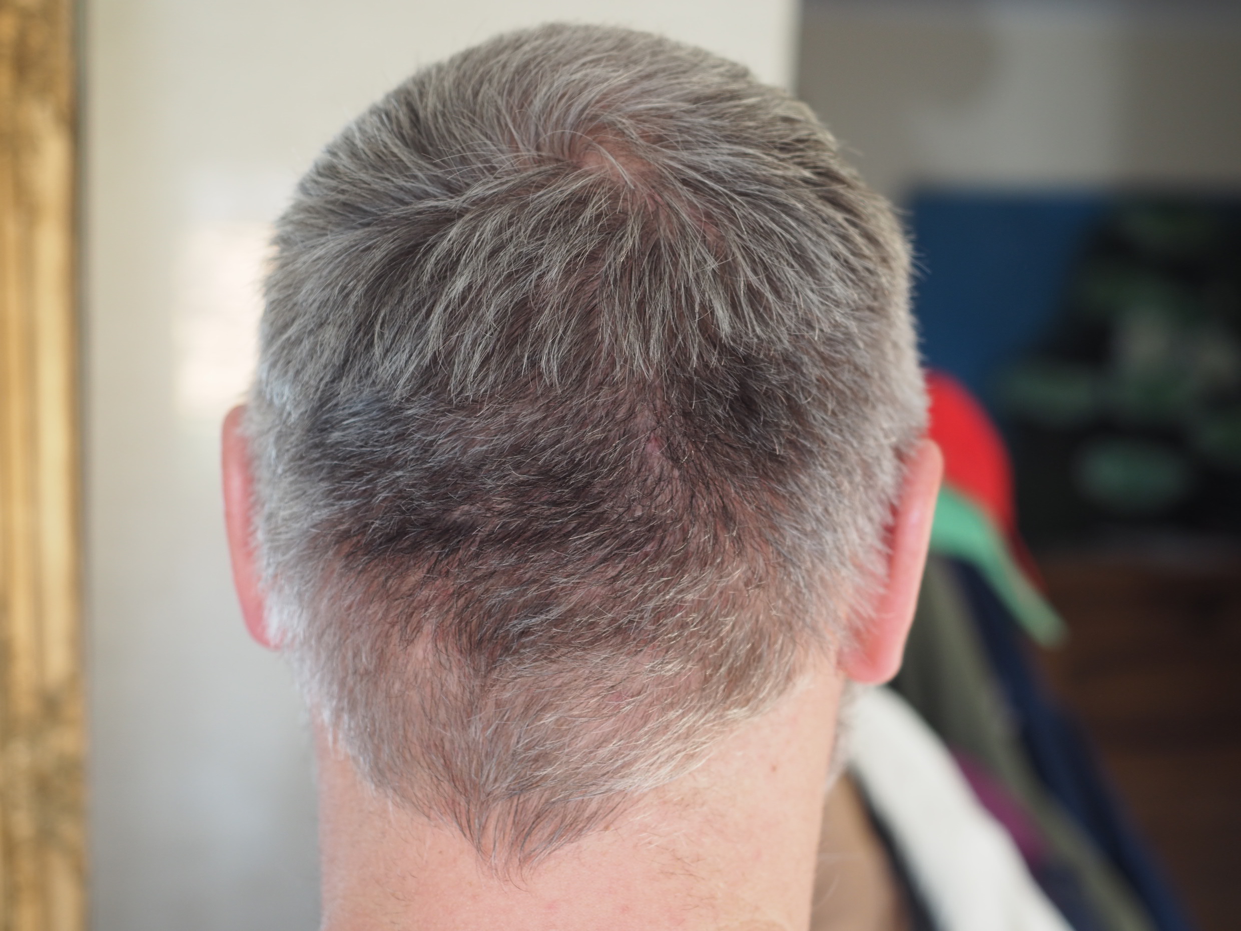 /foren/transplant/index.php/fa/50971/0/