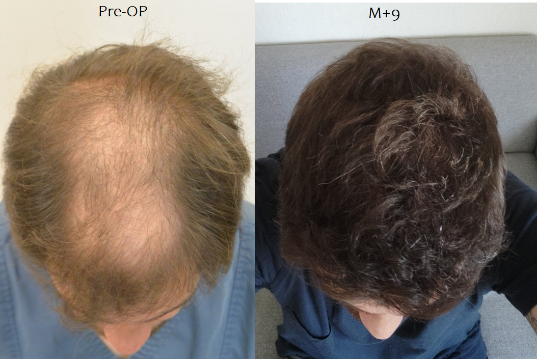 /foren/transplant/index.php/fa/50972/0/