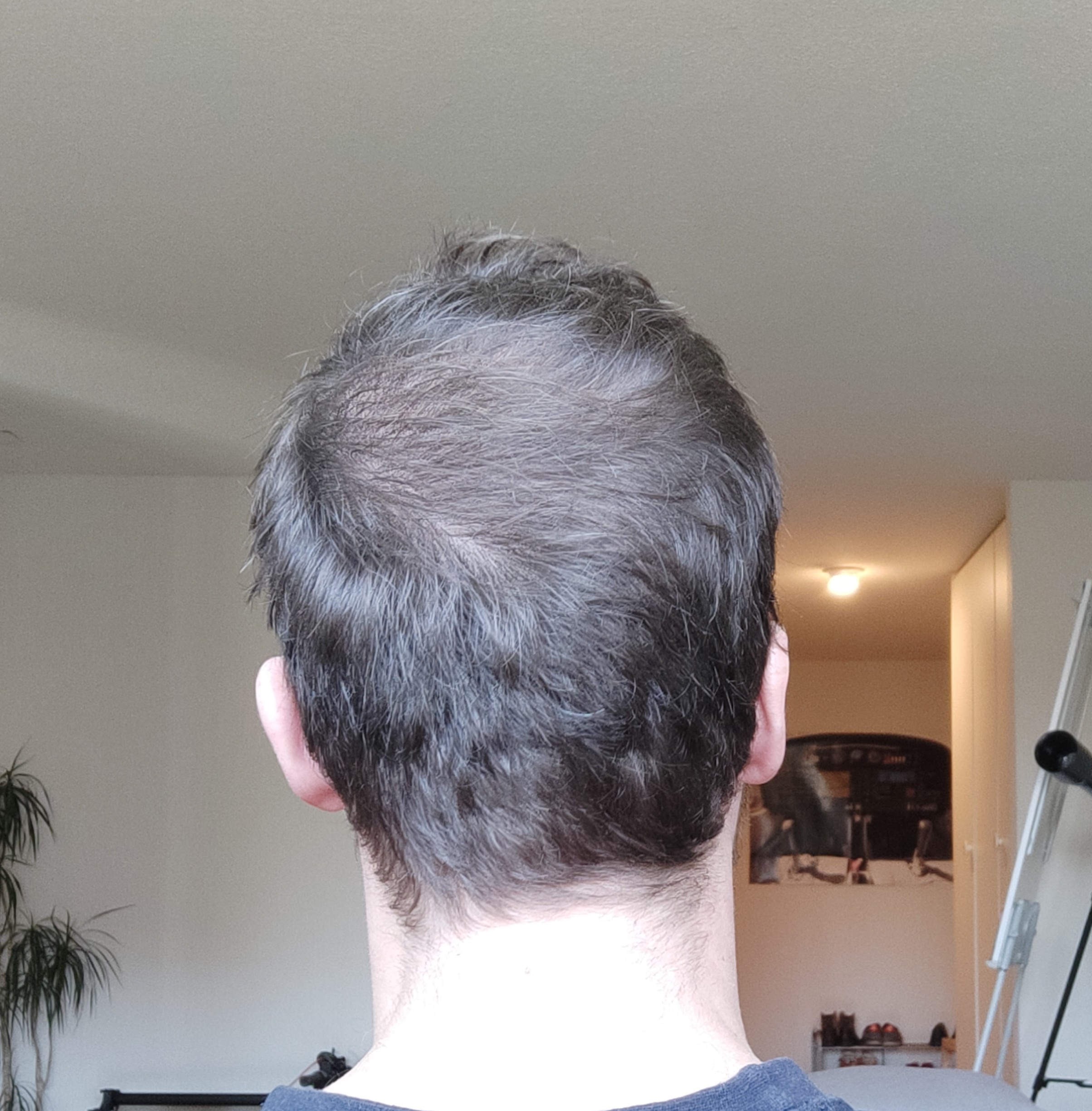 /foren/transplant/index.php/fa/50973/0/