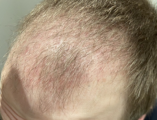 /foren/transplant/index.php/fa/50978/0/