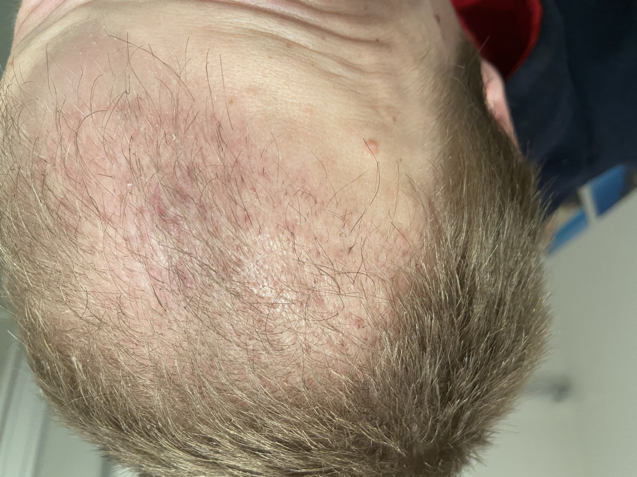 /foren/transplant/index.php/fa/50979/0/