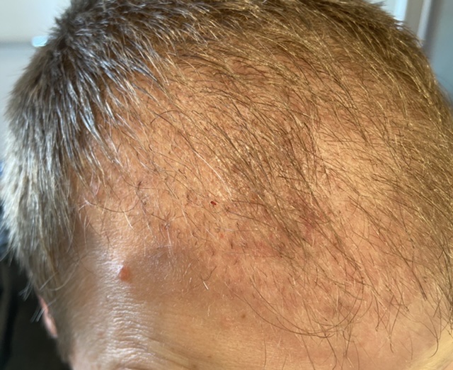 /foren/transplant/index.php/fa/50982/0/