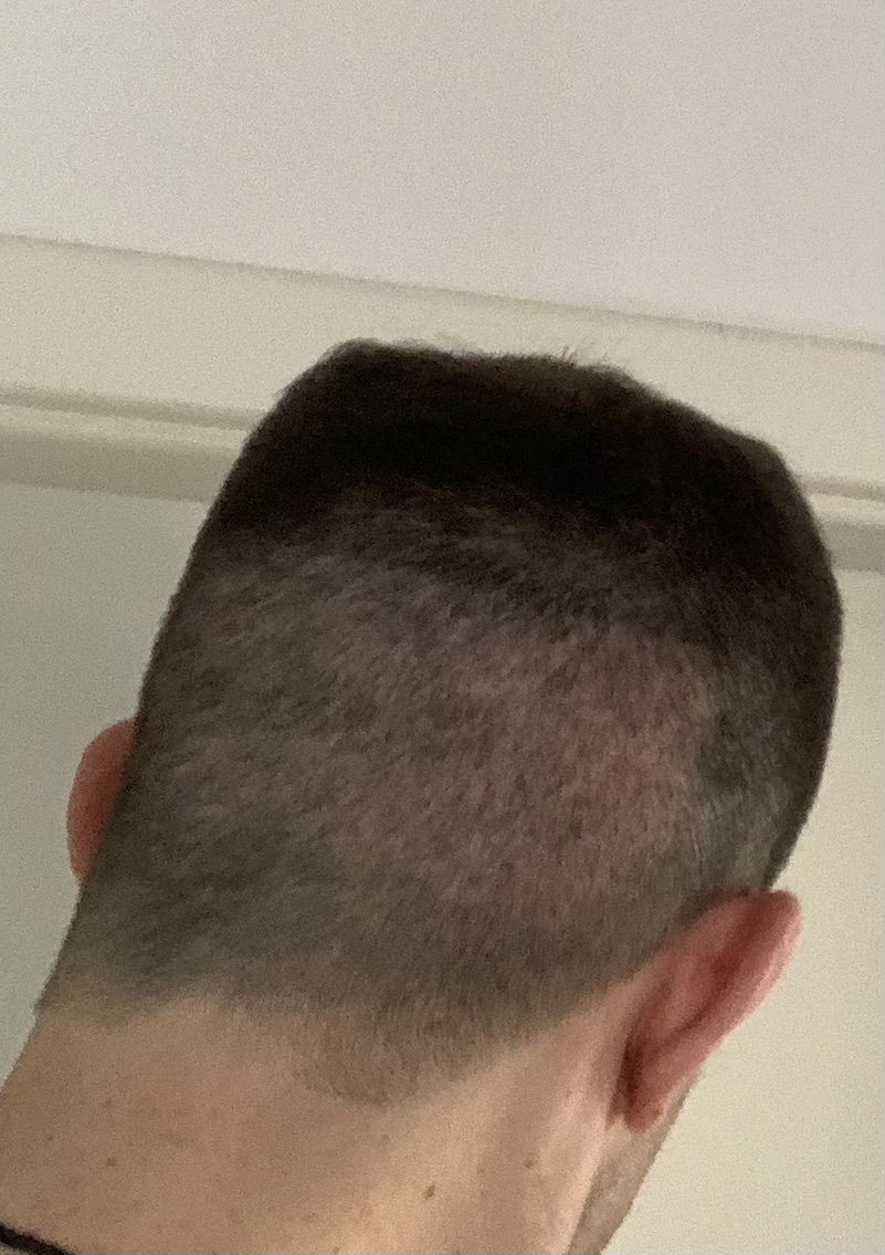 /foren/transplant/index.php/fa/51021/0/