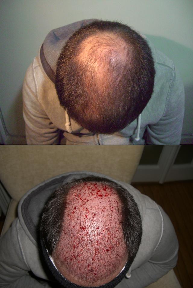 index.php/fa/5103/0/