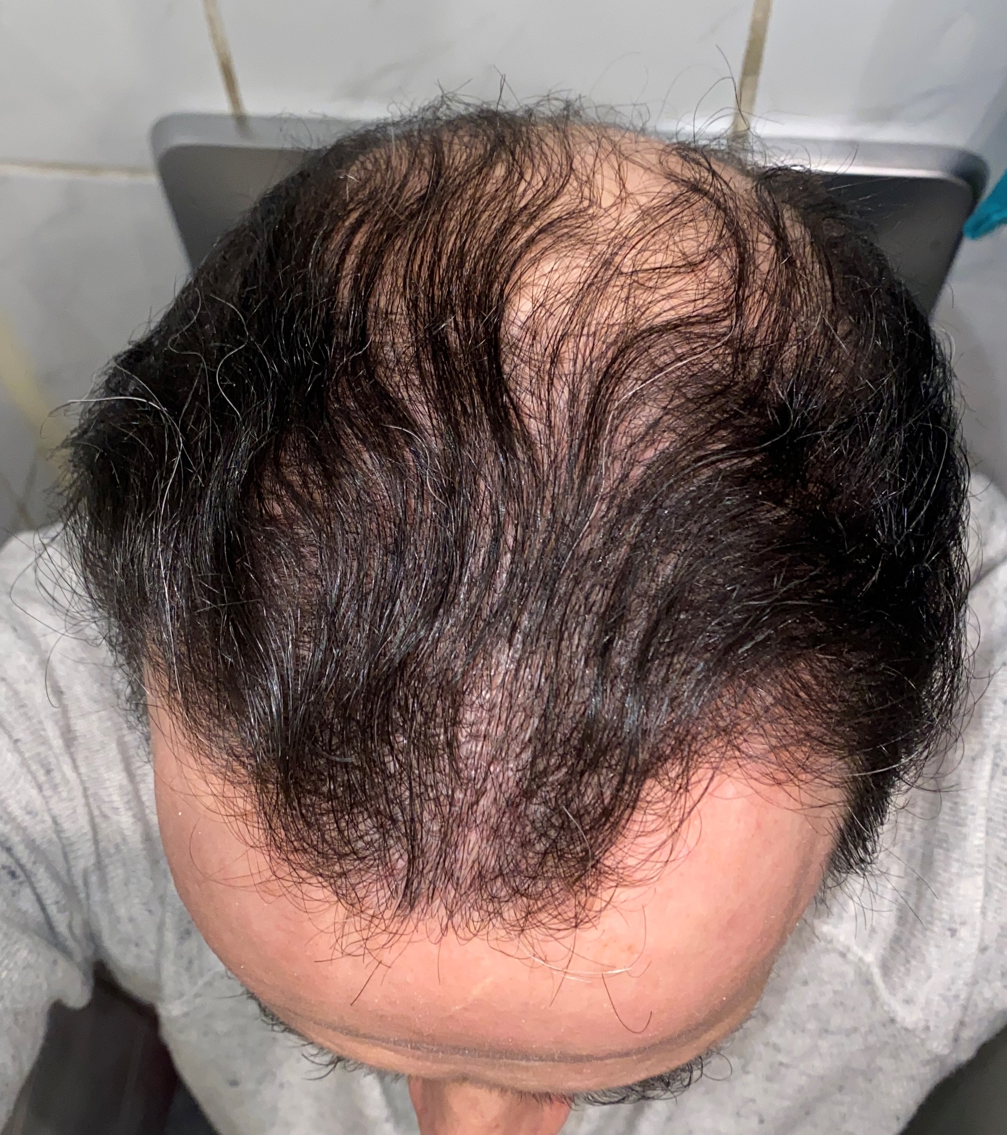 /foren/transplant/index.php/fa/51039/0/