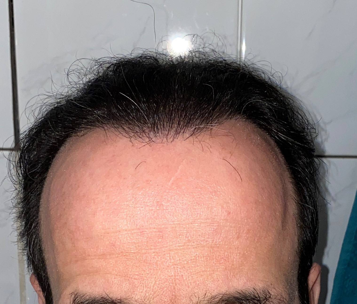 /foren/transplant/index.php/fa/51040/0/