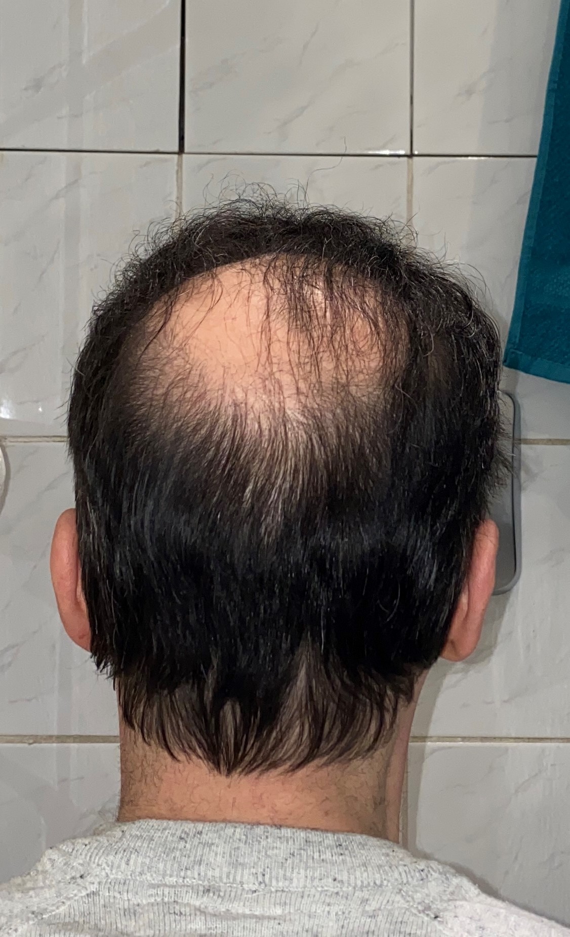 /foren/transplant/index.php/fa/51041/0/