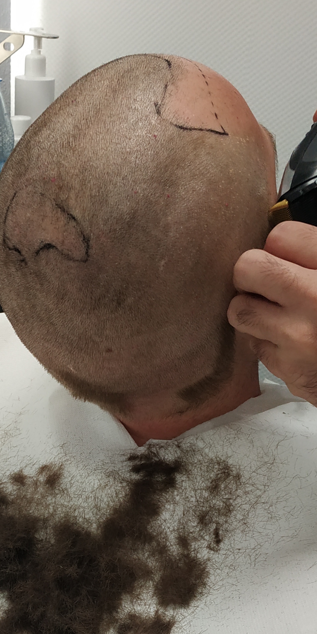 /foren/transplant/index.php/fa/51066/0/