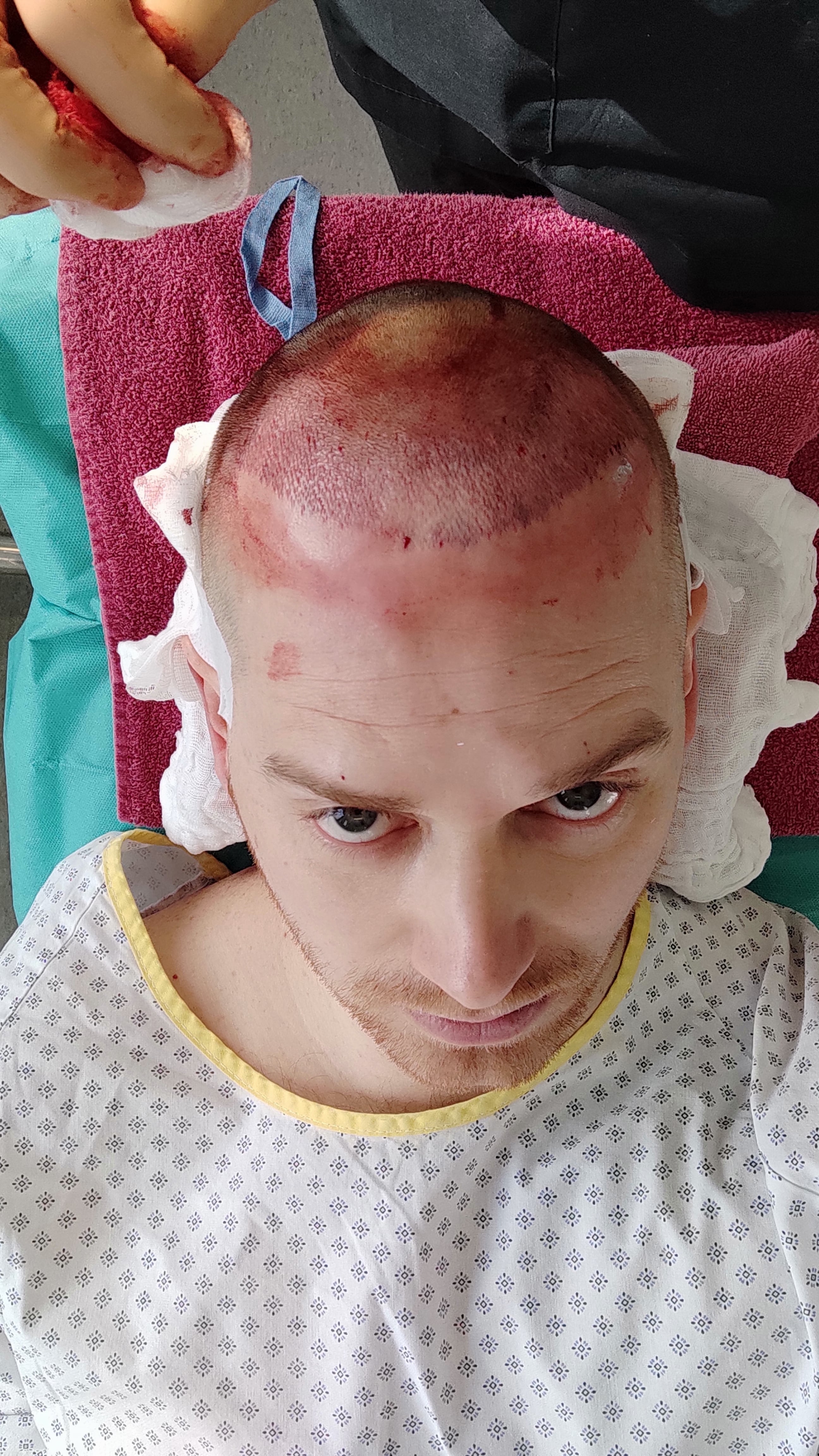 /foren/transplant/index.php/fa/51069/0/