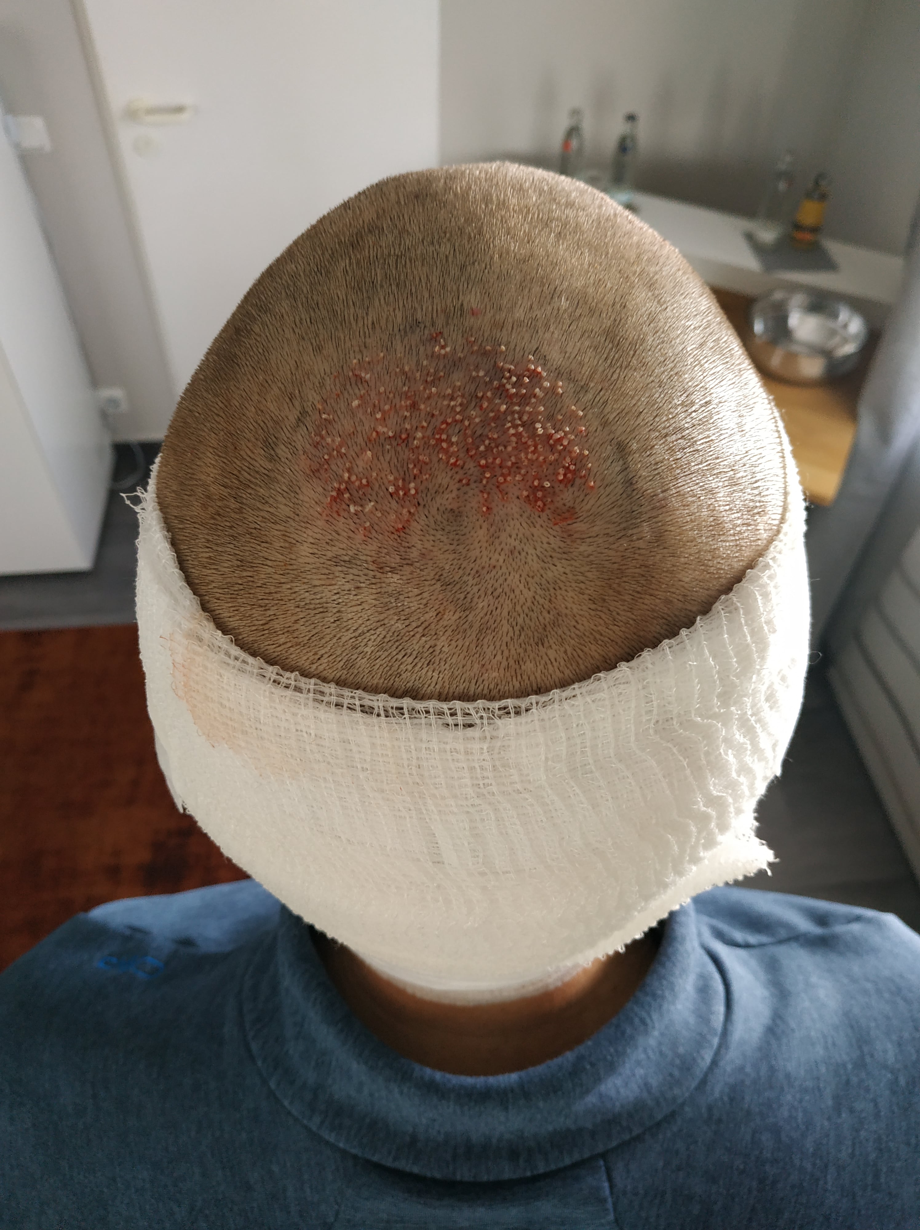 /foren/transplant/index.php/fa/51072/0/