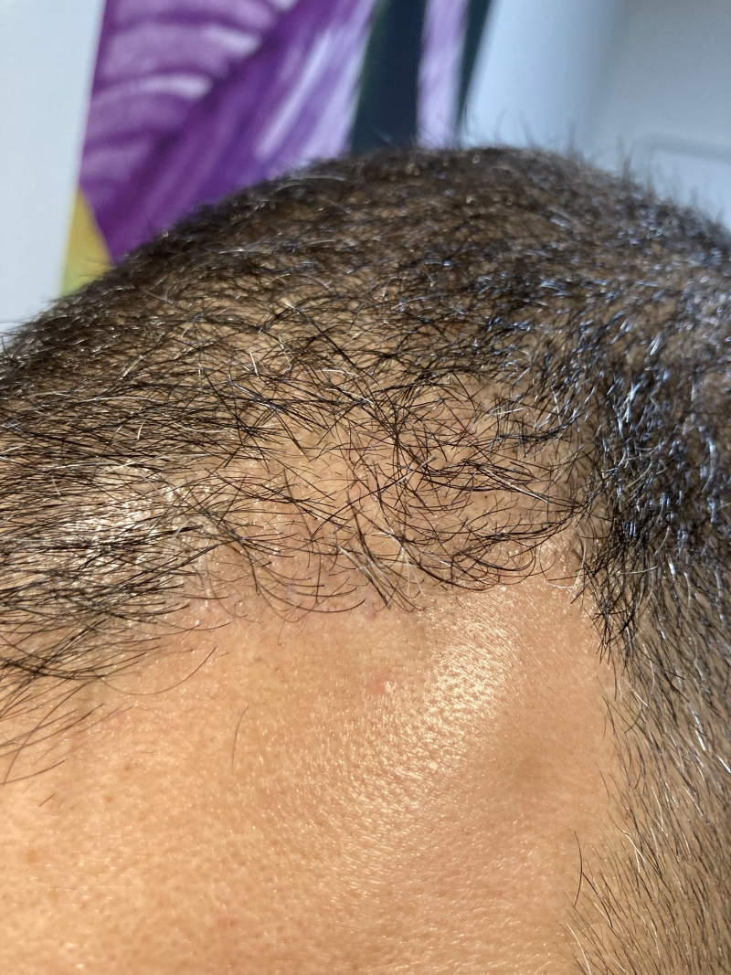 /foren/transplant/index.php/fa/51092/0/