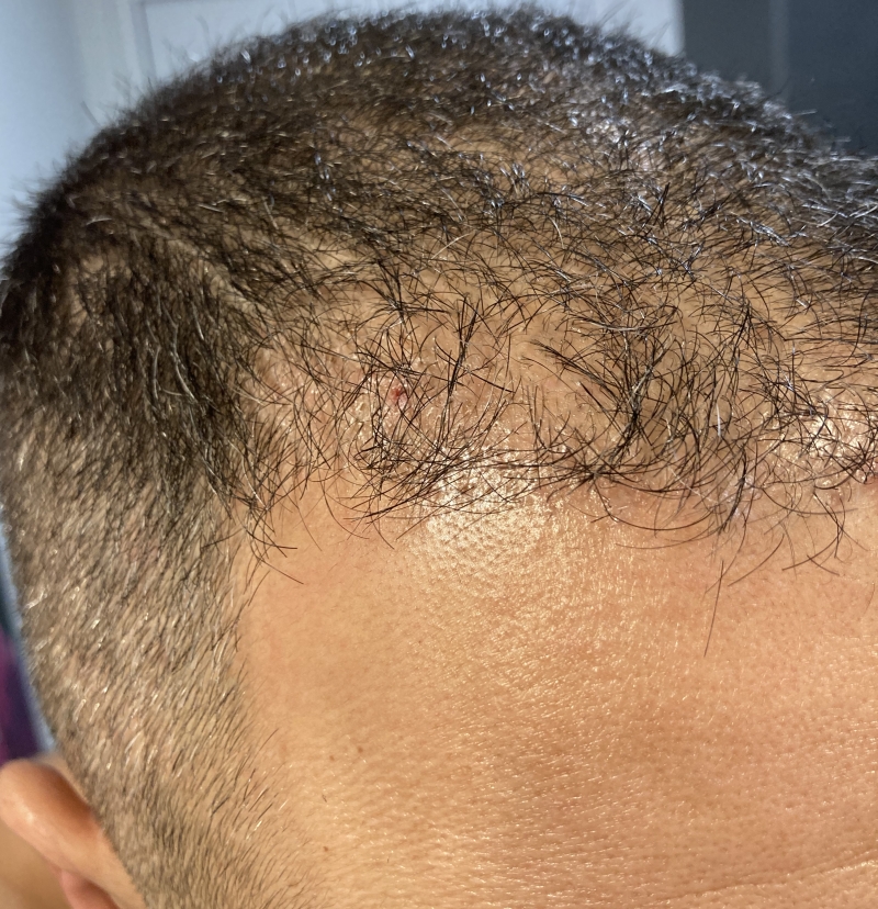 /foren/transplant/index.php/fa/51093/0/