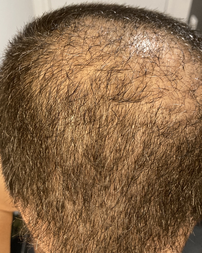 /foren/transplant/index.php/fa/51094/0/