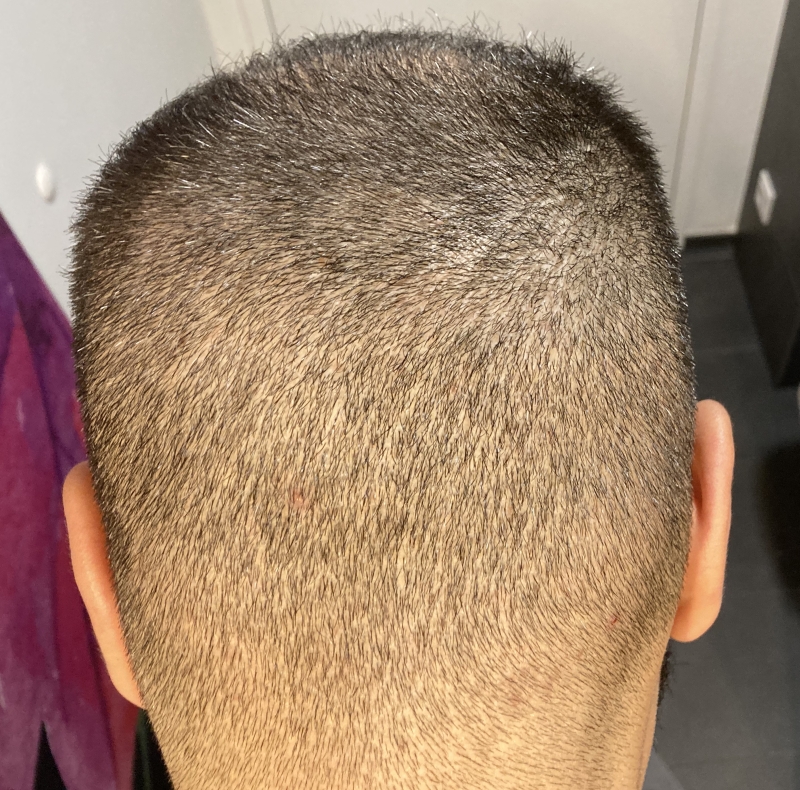 /foren/transplant/index.php/fa/51095/0/