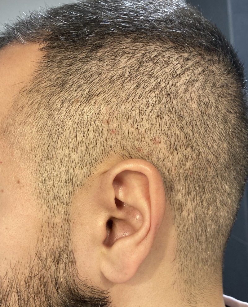 /foren/transplant/index.php/fa/51096/0/