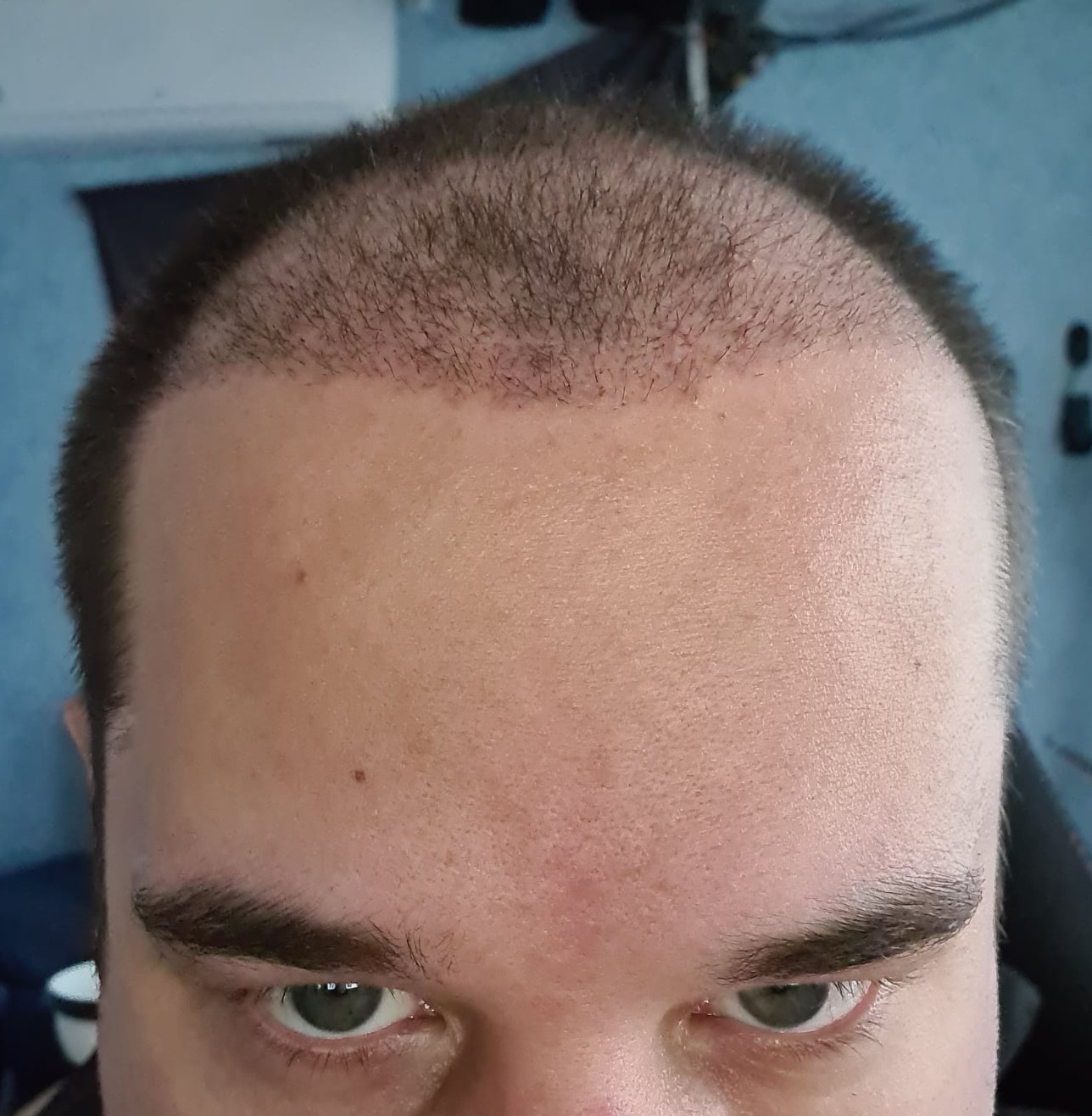 /foren/transplant/index.php/fa/51110/0/