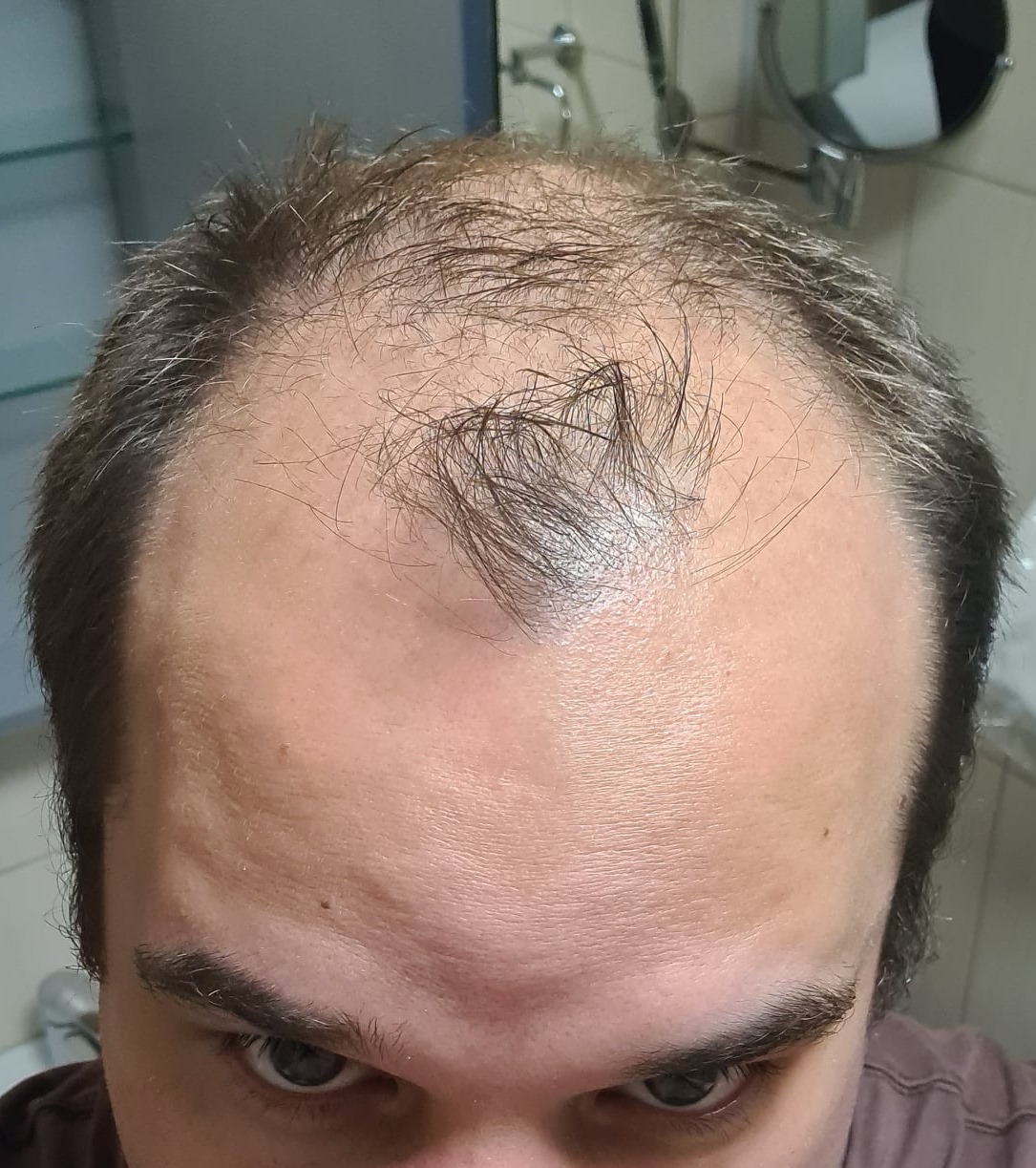 /foren/transplant/index.php/fa/51112/0/