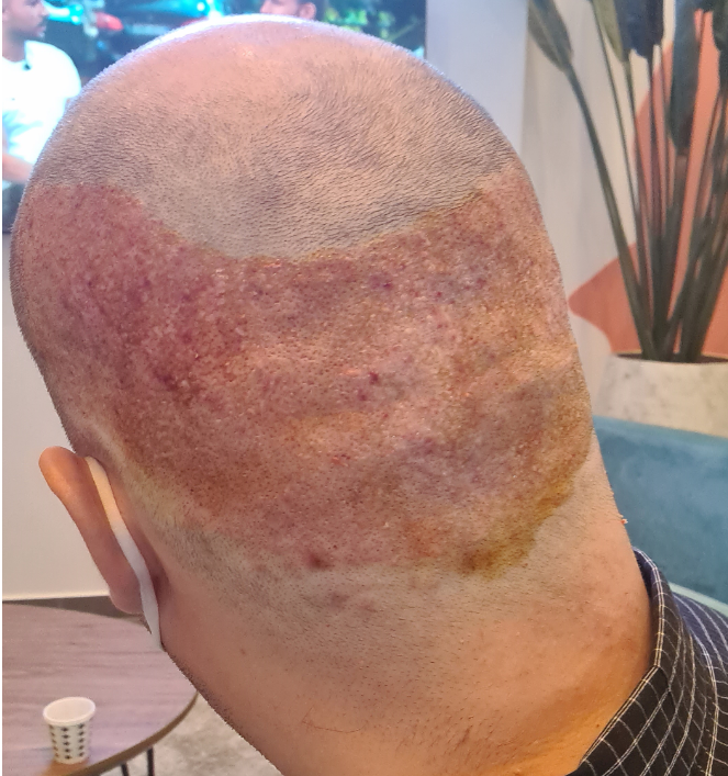 /foren/transplant/index.php/fa/51118/0/