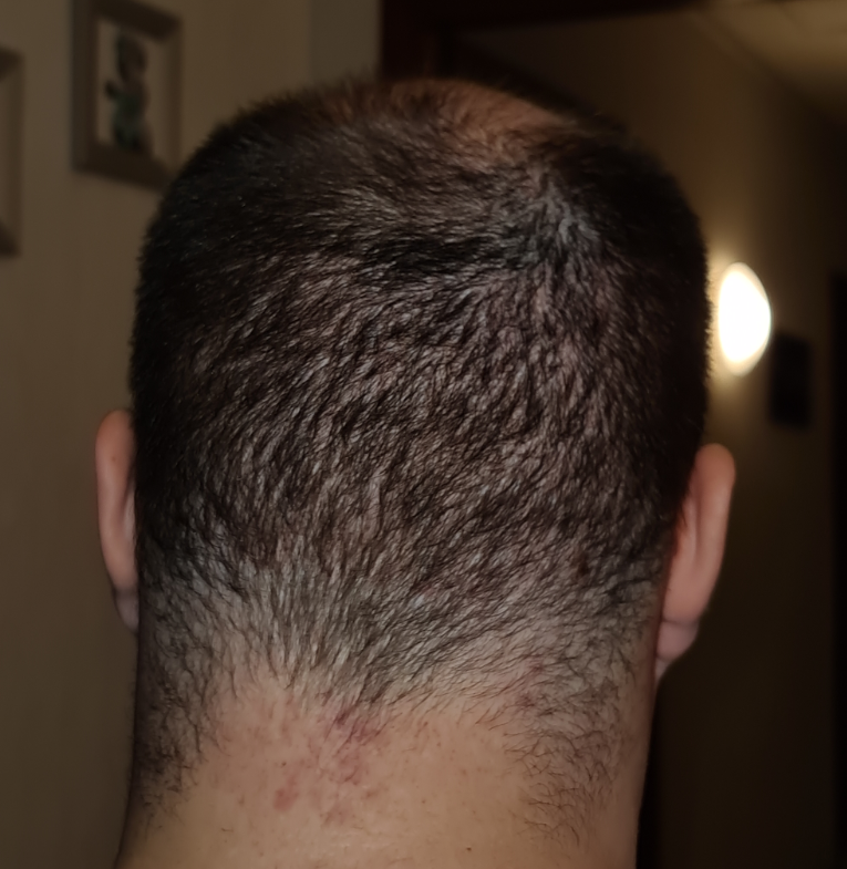 /foren/transplant/index.php/fa/51119/0/