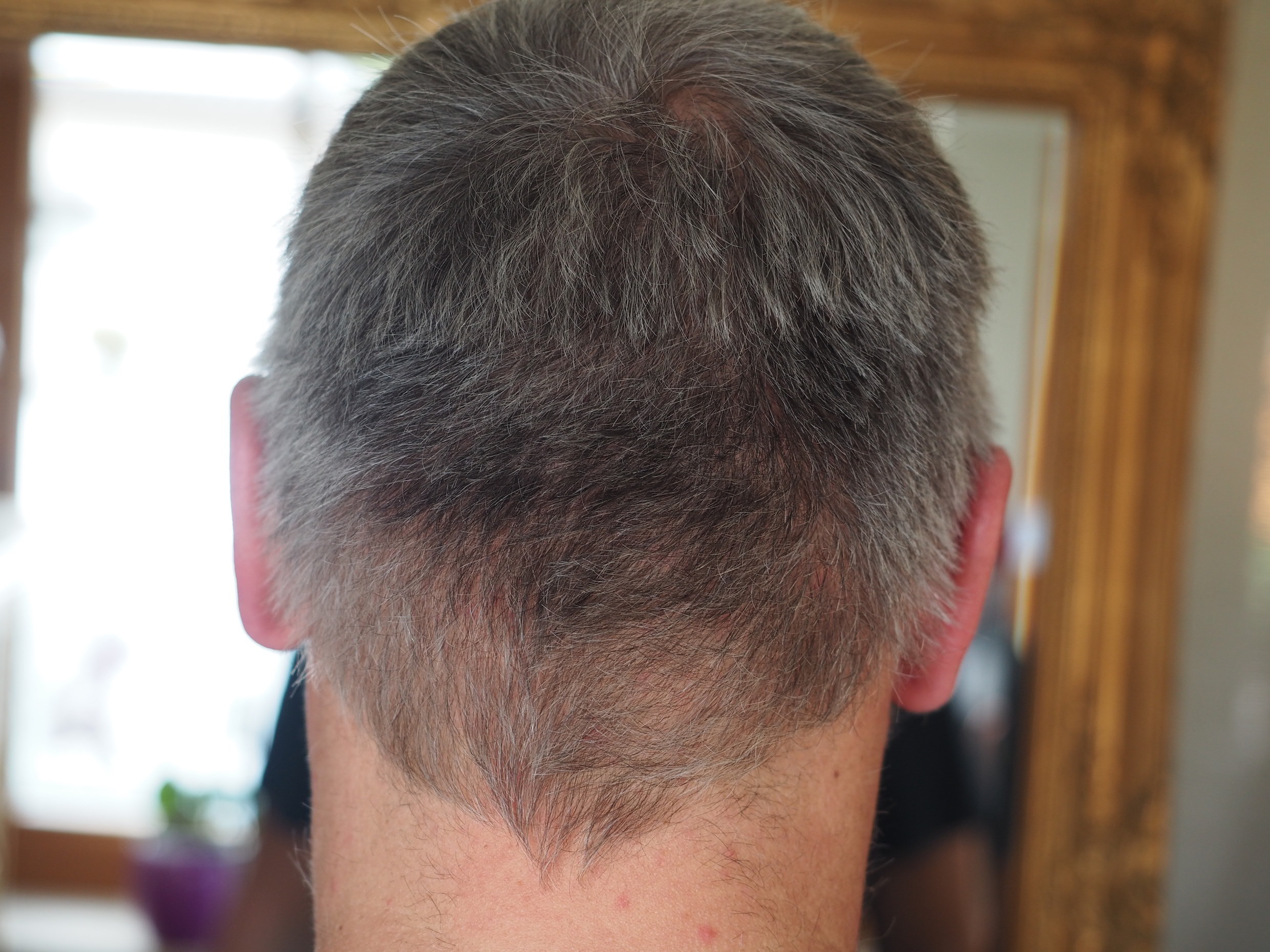 /foren/transplant/index.php/fa/51135/0/