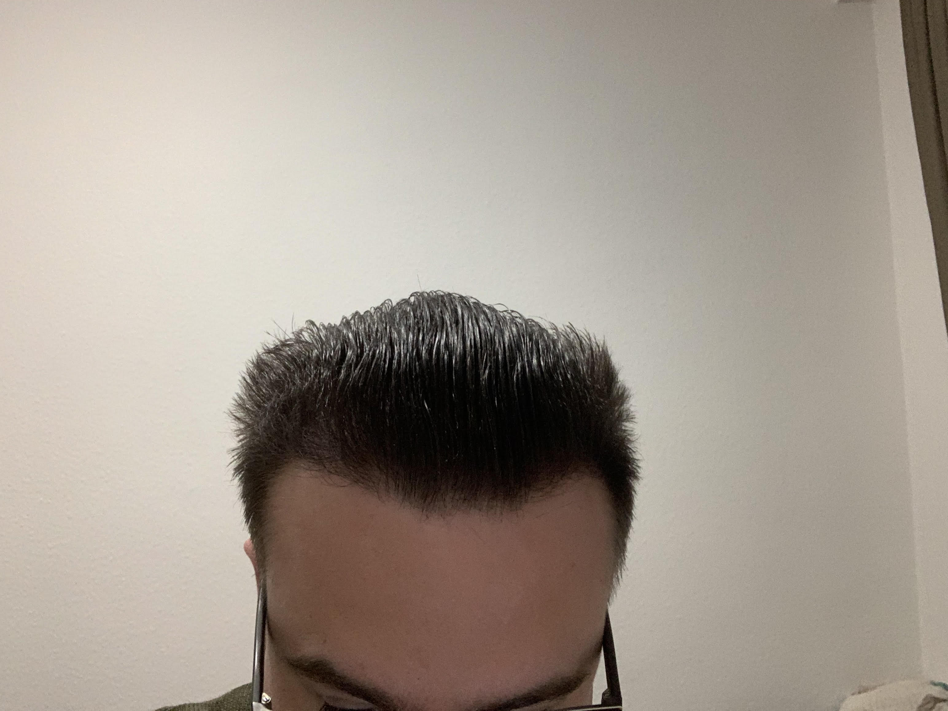 /foren/transplant/index.php/fa/51171/0/