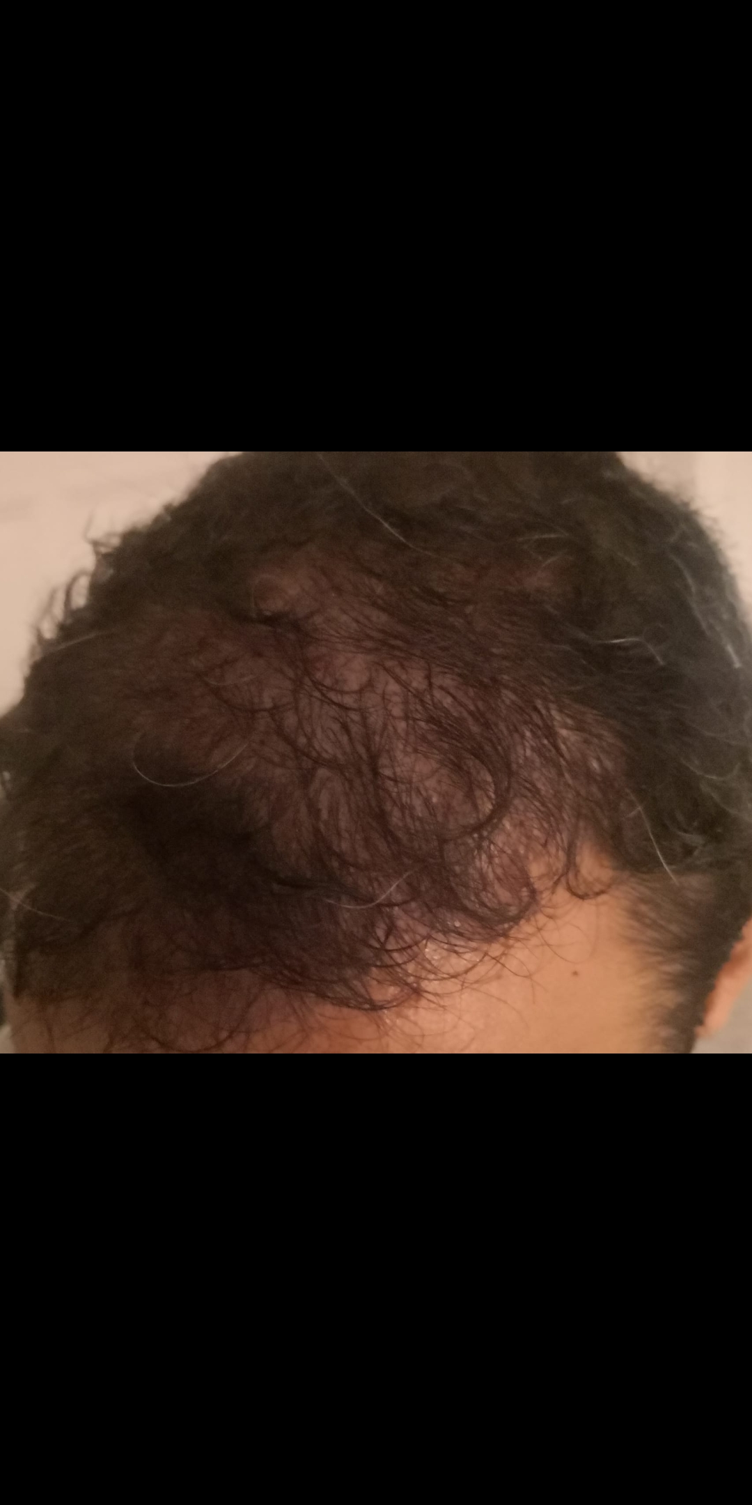 /foren/transplant/index.php/fa/51219/0/