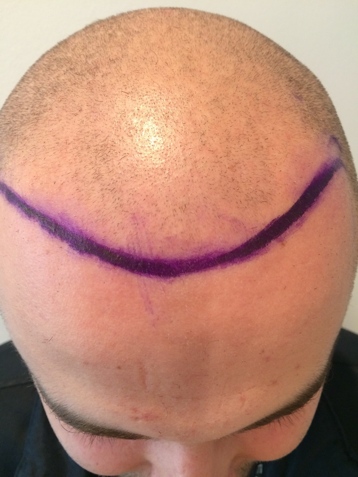 /foren/transplant/index.php/fa/51223/0/