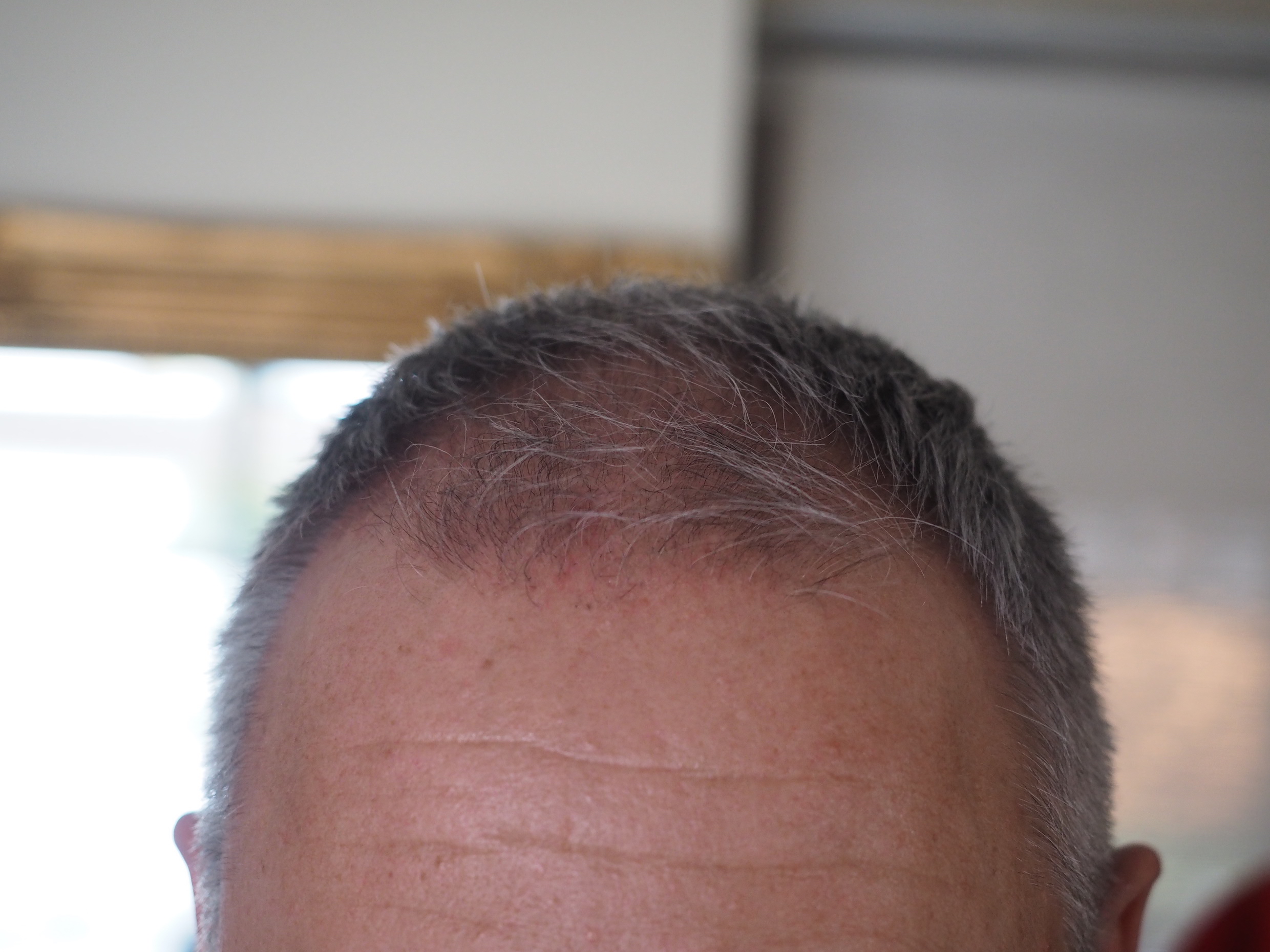 /foren/transplant/index.php/fa/51255/0/