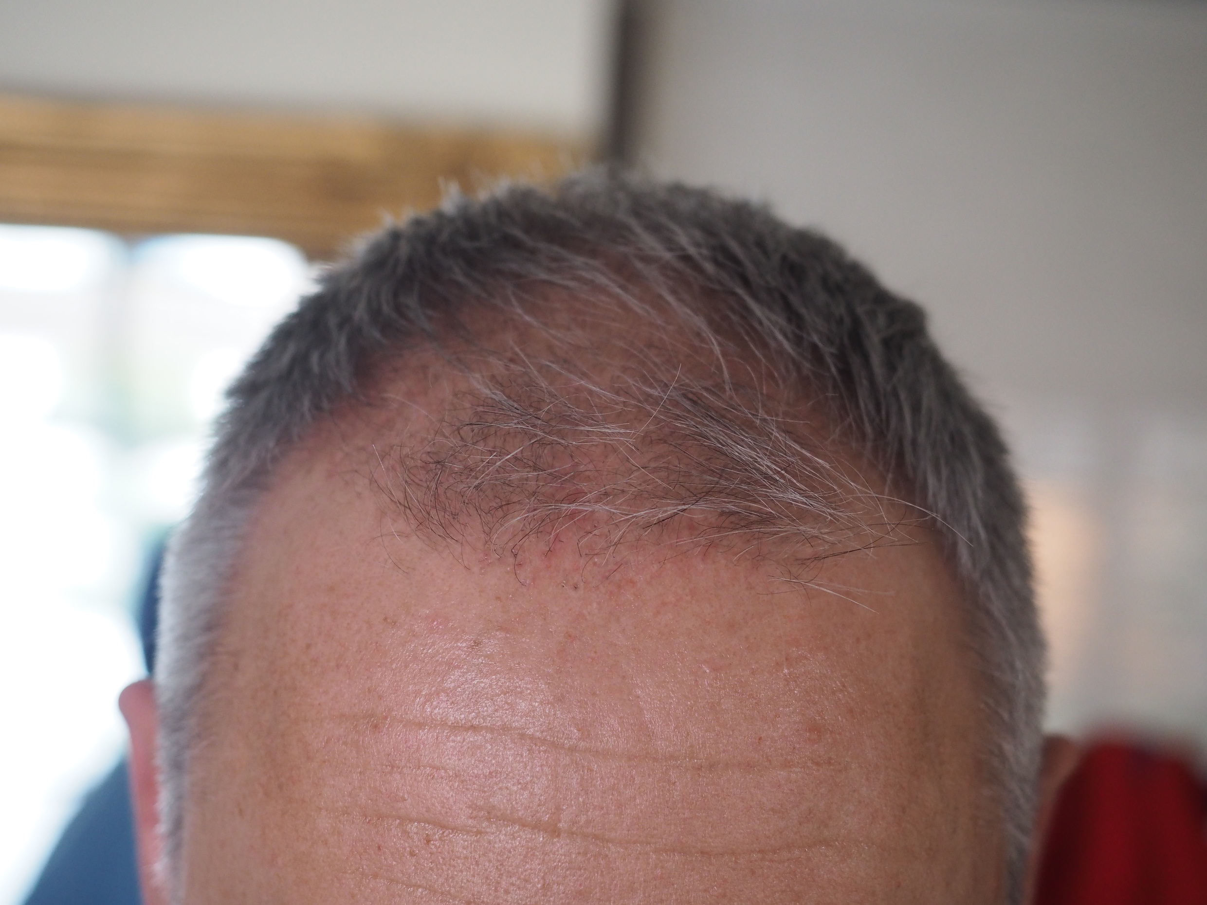 /foren/transplant/index.php/fa/51256/0/