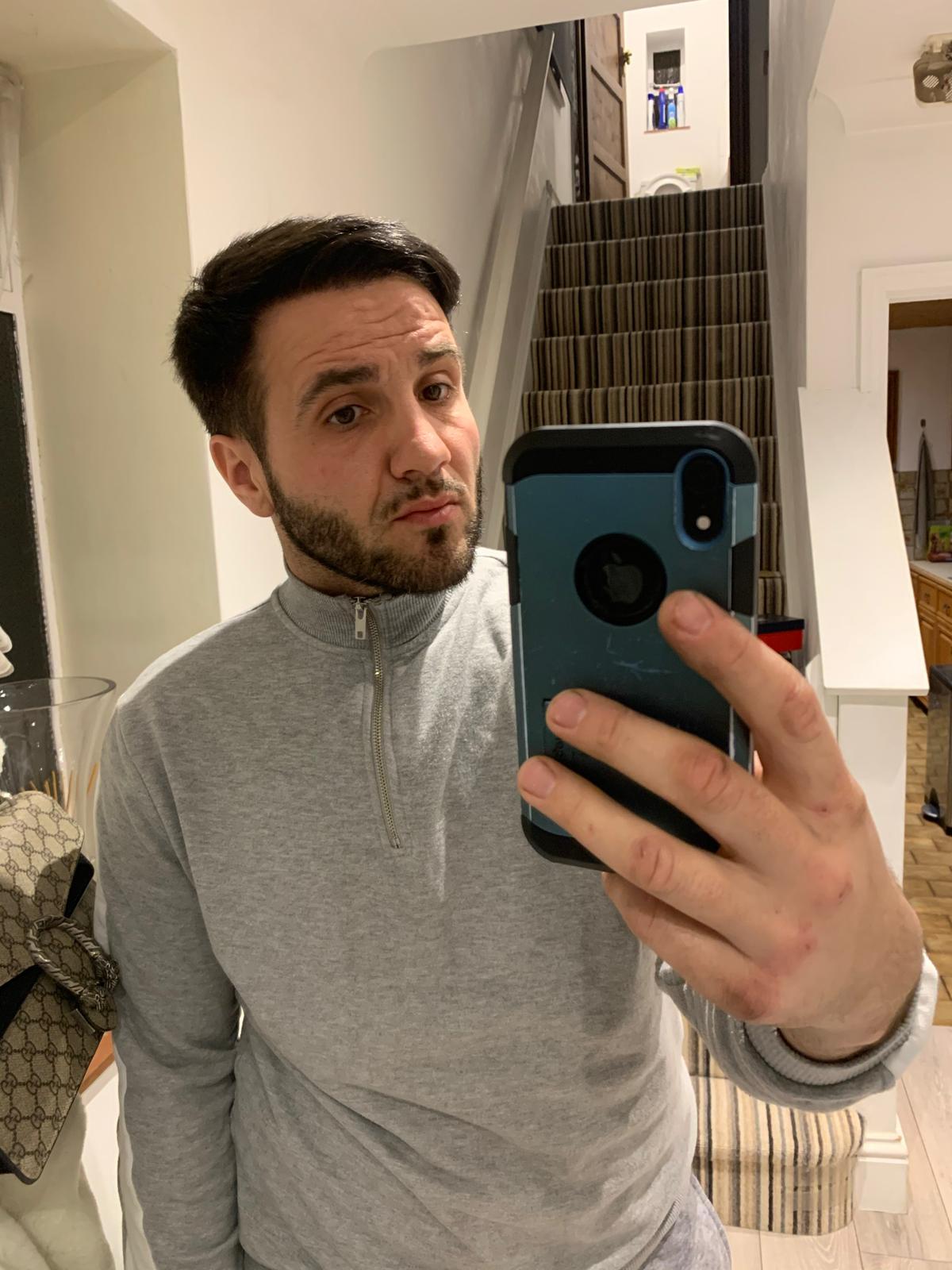 /foren/transplant/index.php/fa/51272/0/