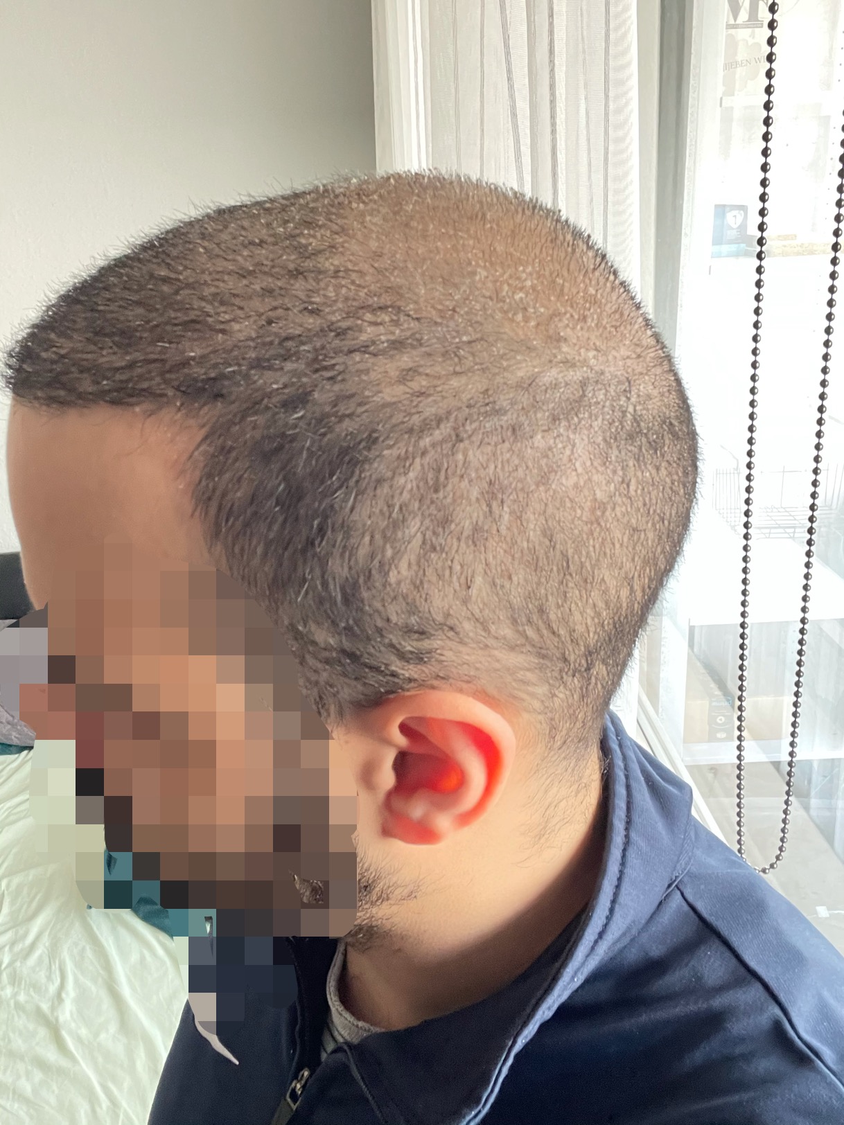 /foren/transplant/index.php/fa/51351/0/